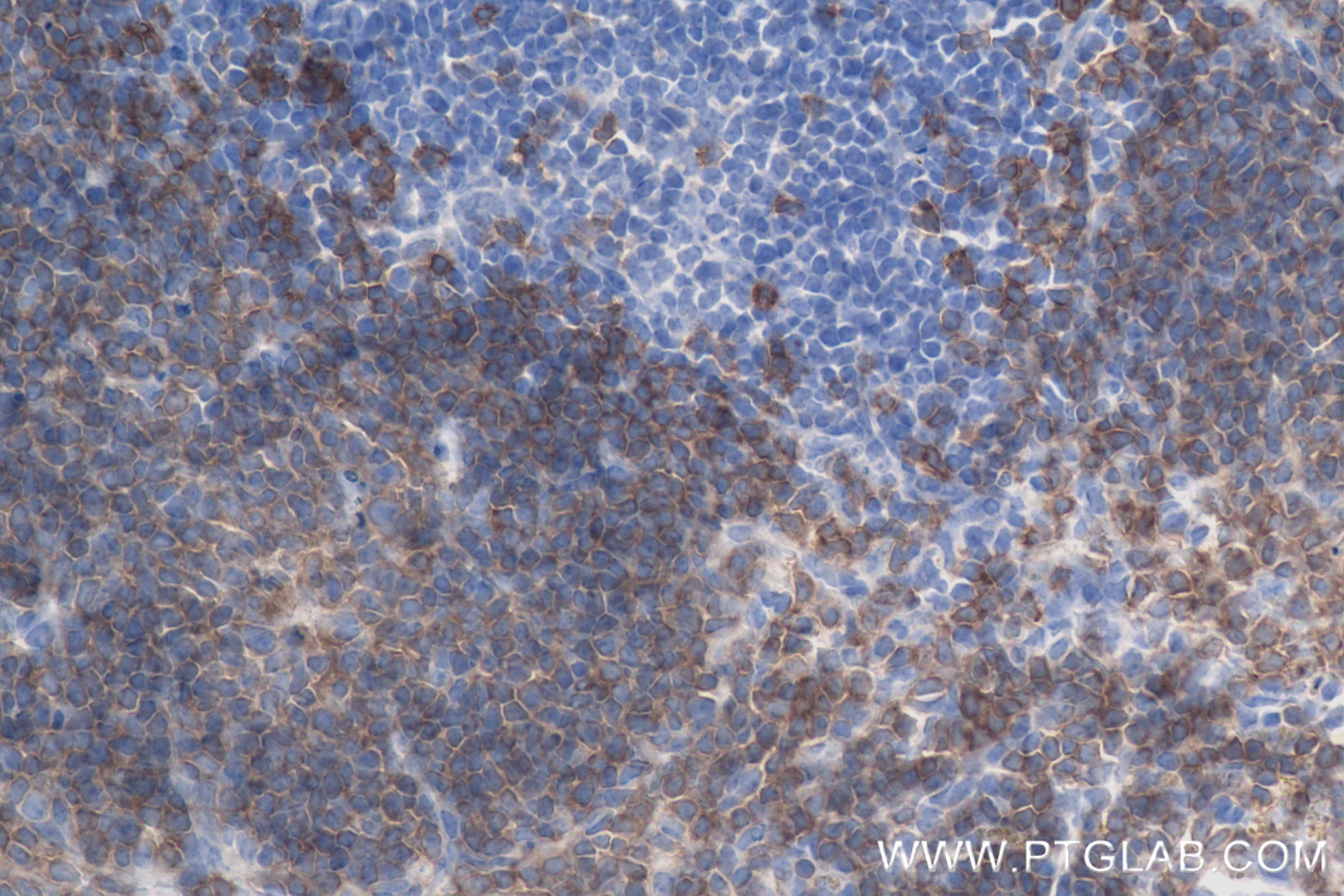 IHC staining of mouse spleen using 83254-1-RR
