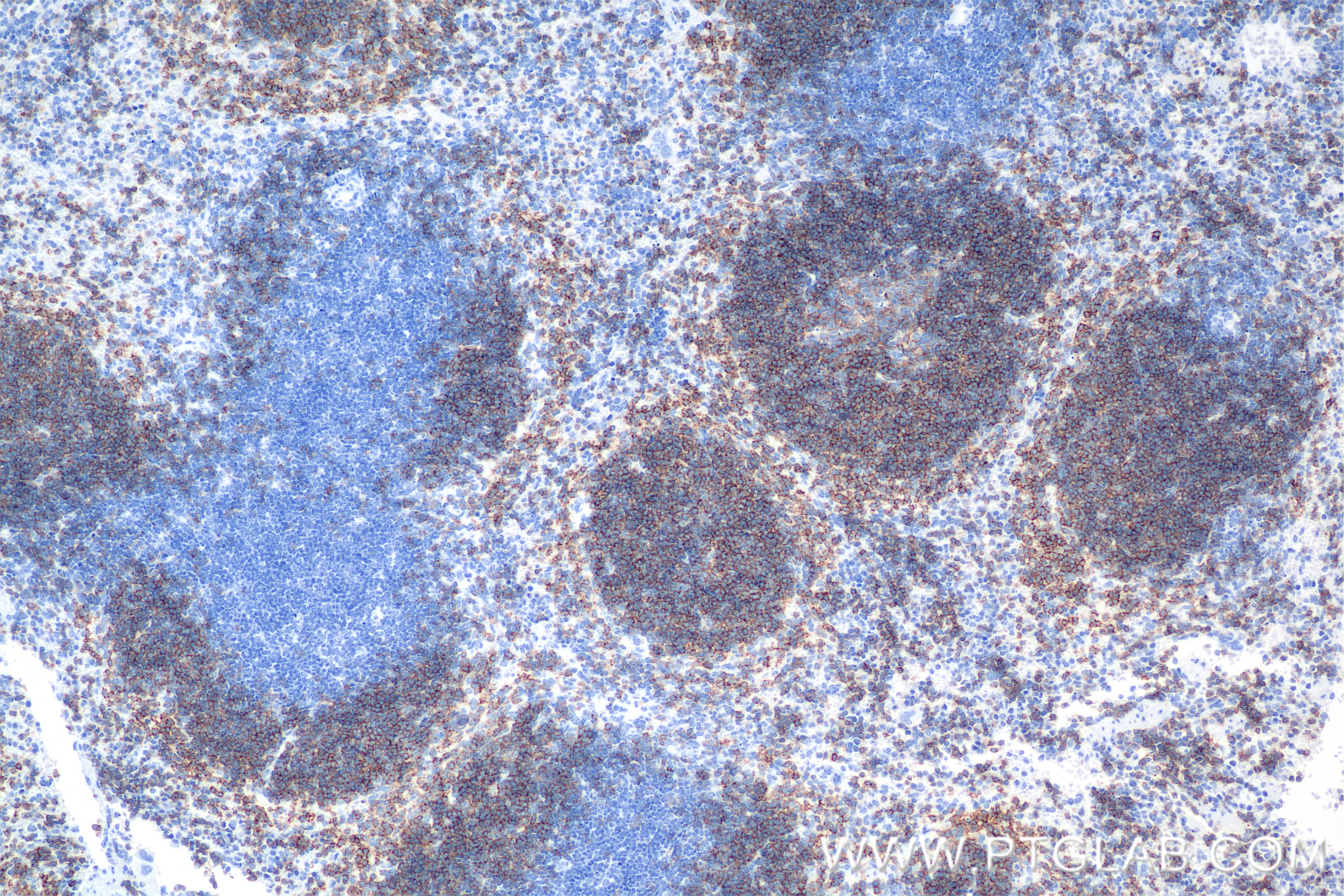 IHC staining of mouse spleen using 84848-5-RR