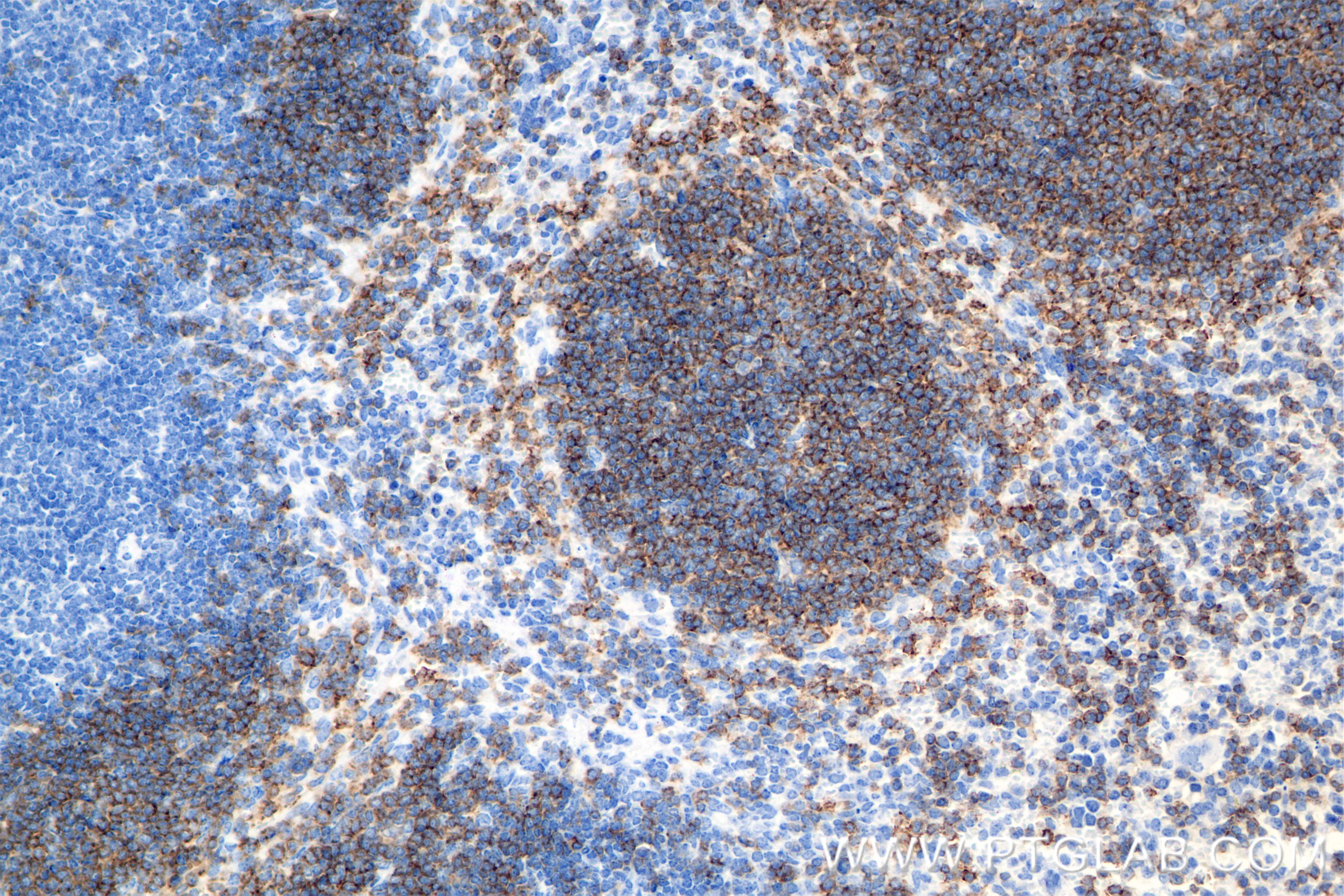 IHC staining of mouse spleen using 84848-5-RR