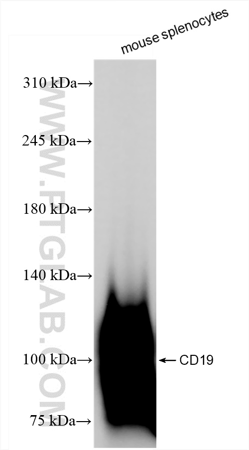WB analysis of mouse splenocytes using 84848-5-RR