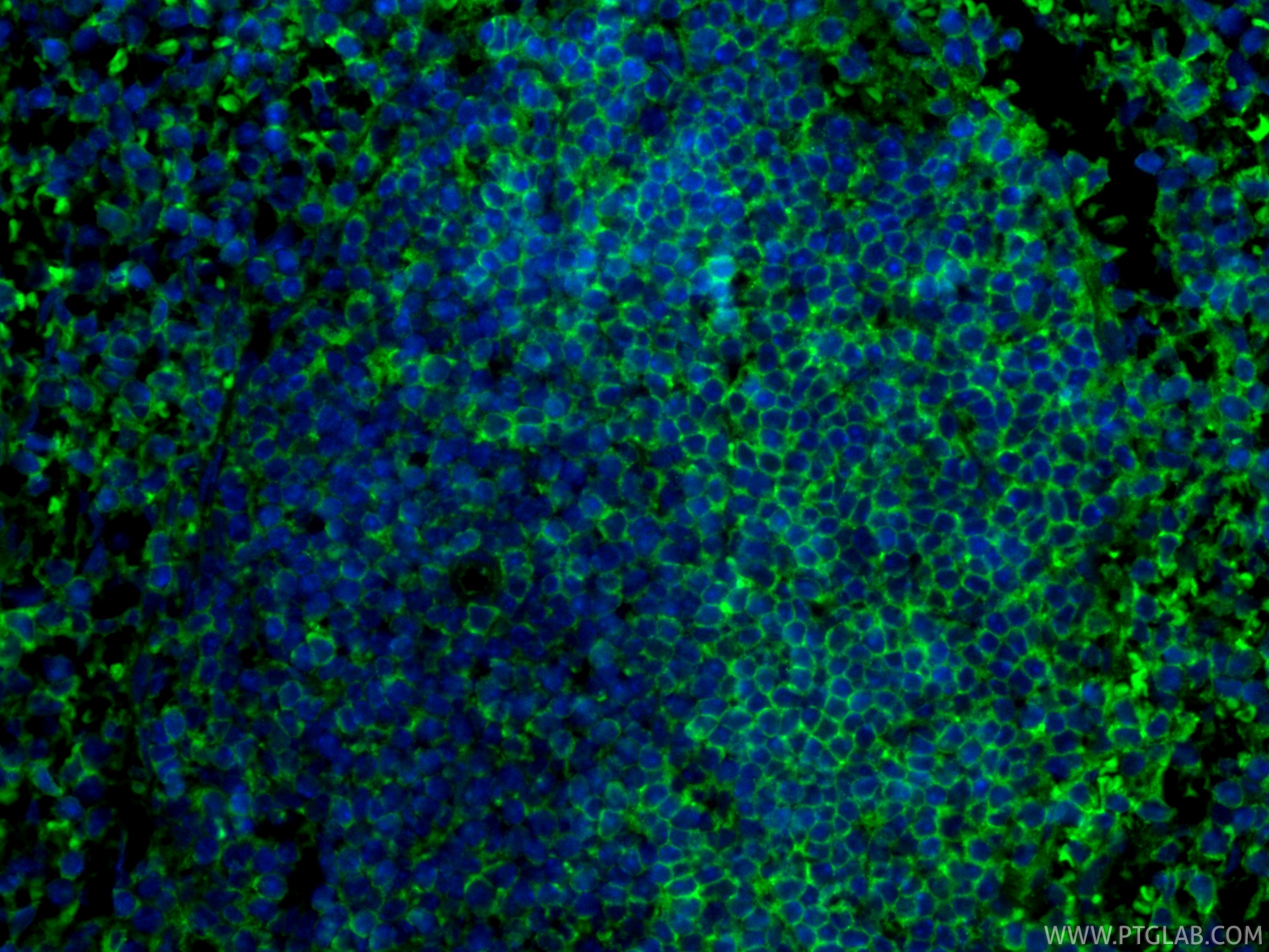 Immunofluorescent analysis of (4% PFA) fixed paraffin-embedded mouse spleen tissue using CoraLite® Plus 488 CD19 antibody (CL488-83254, Clone: 240135A3 ) at dilution of 1:200. Heat mediated antigen retrieval with Tris-EDTA buffer (pH 9.0). IF Staining of mouse spleen using CL488-83254
