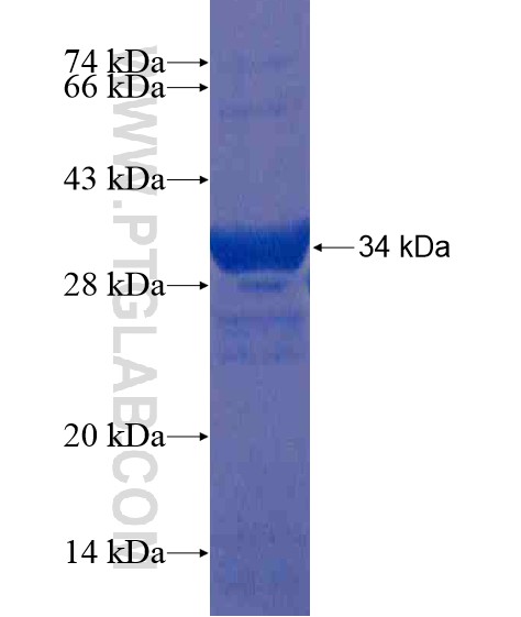 CD1A fusion protein Ag20854 SDS-PAGE