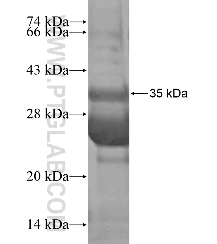 CD1C fusion protein Ag18014 SDS-PAGE CD1C fusion protein Ag18014 SDS-PAGE