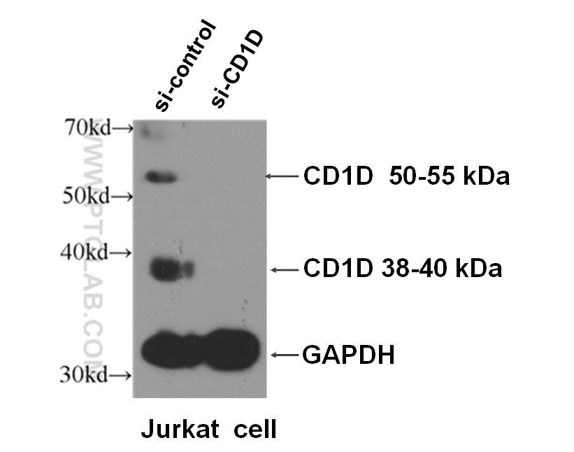 CD1d