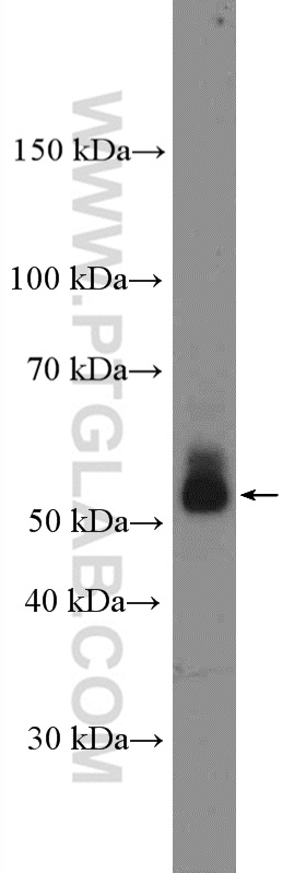 WB analysis of mouse skin using 17336-1-AP