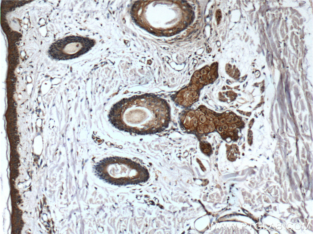 IHC staining of human skin using 66257-1-Ig