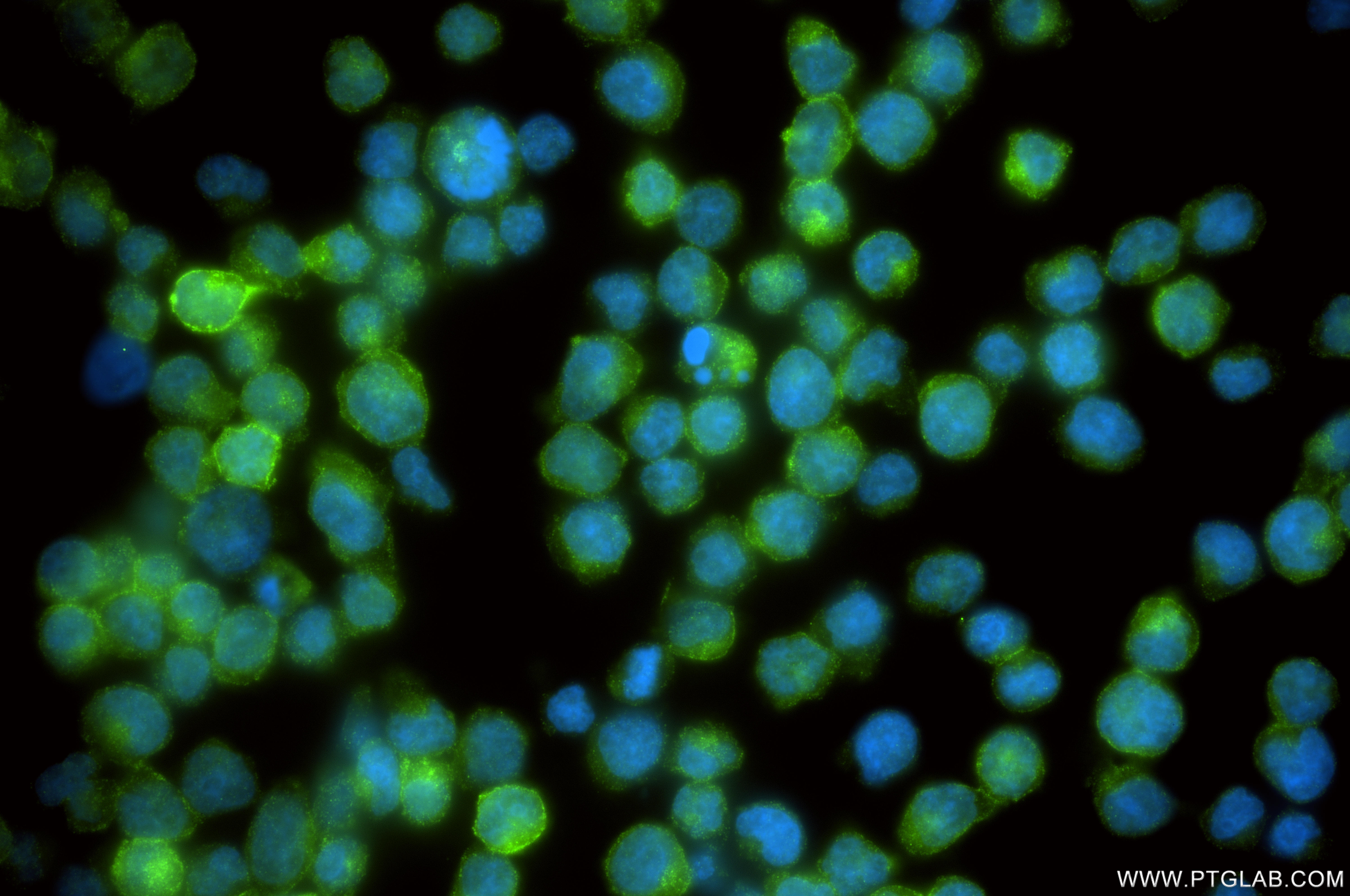 IF Staining of Jurkat using 87145-2-RR IF Staining of Jurkat using 87145-2-RR