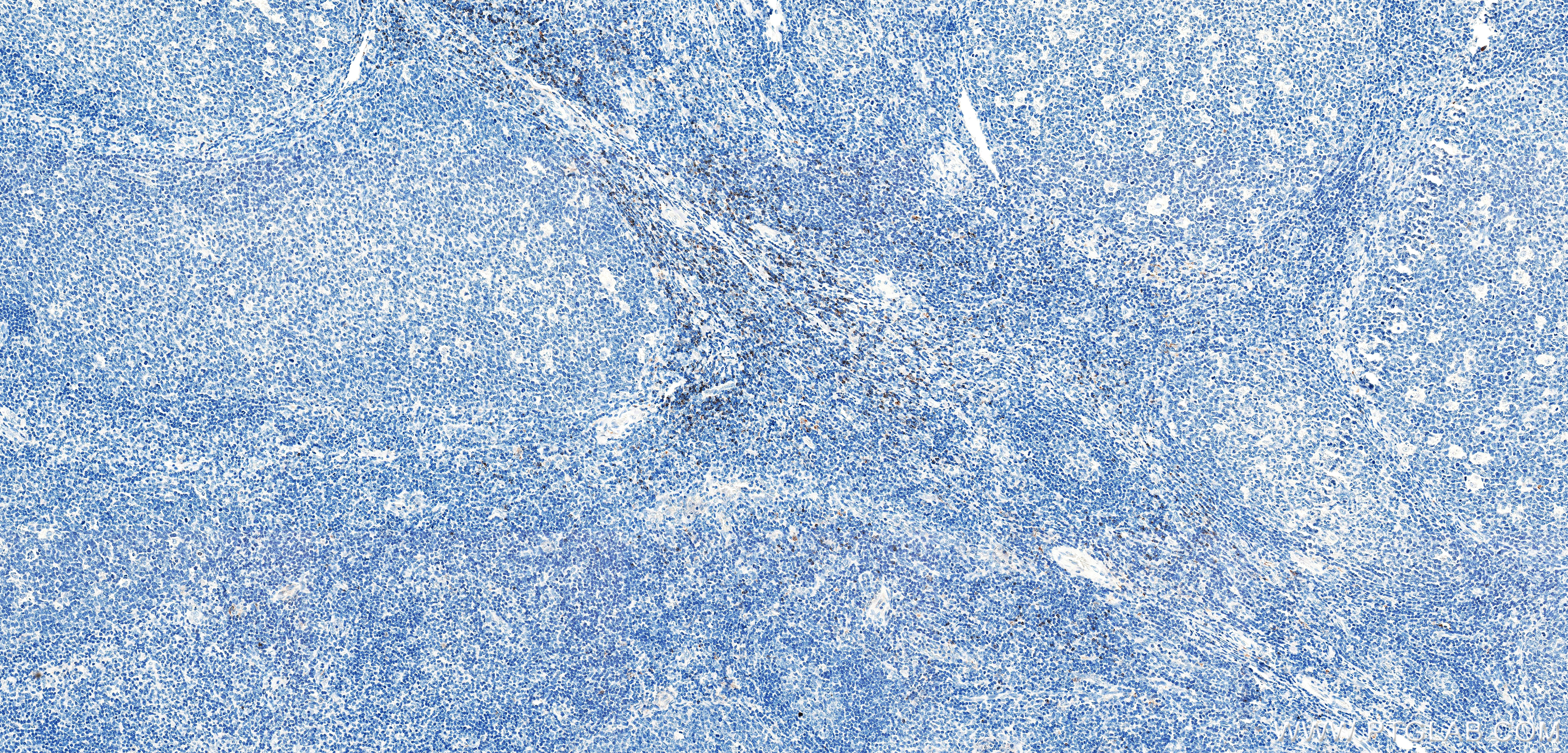 IHC staining of human tonsil using 87398-1-RR (same clone as 87398-1-PBS) IHC staining of human tonsil using 87398-1-RR (same clone as 87398-1-PBS)