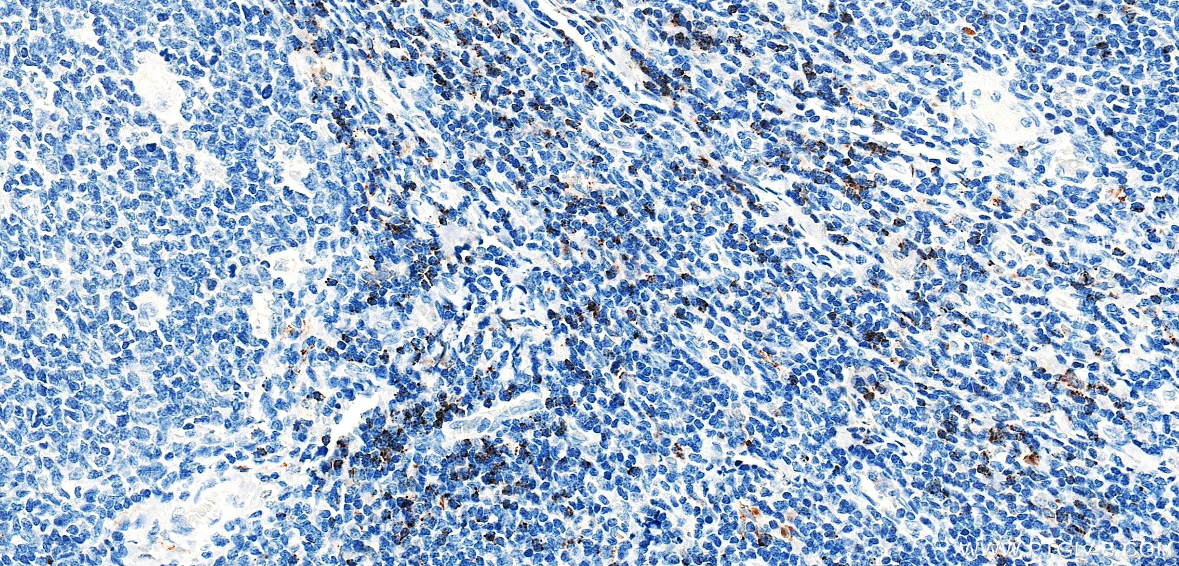 IHC staining of human tonsil using 87398-1-RR (same clone as 87398-1-PBS) IHC staining of human tonsil using 87398-1-RR (same clone as 87398-1-PBS)