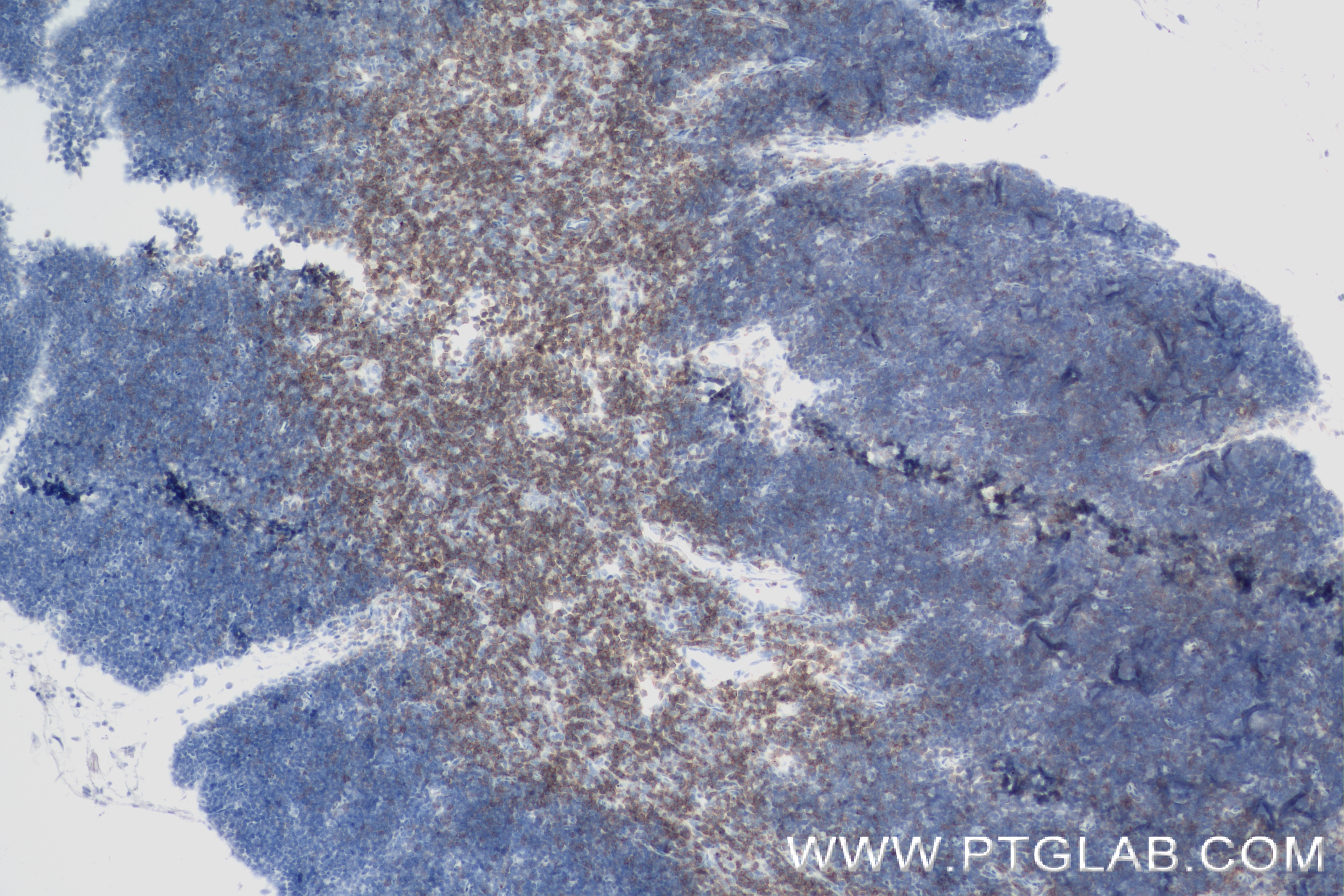 IHC staining of mouse thymus using 84360-4-RR