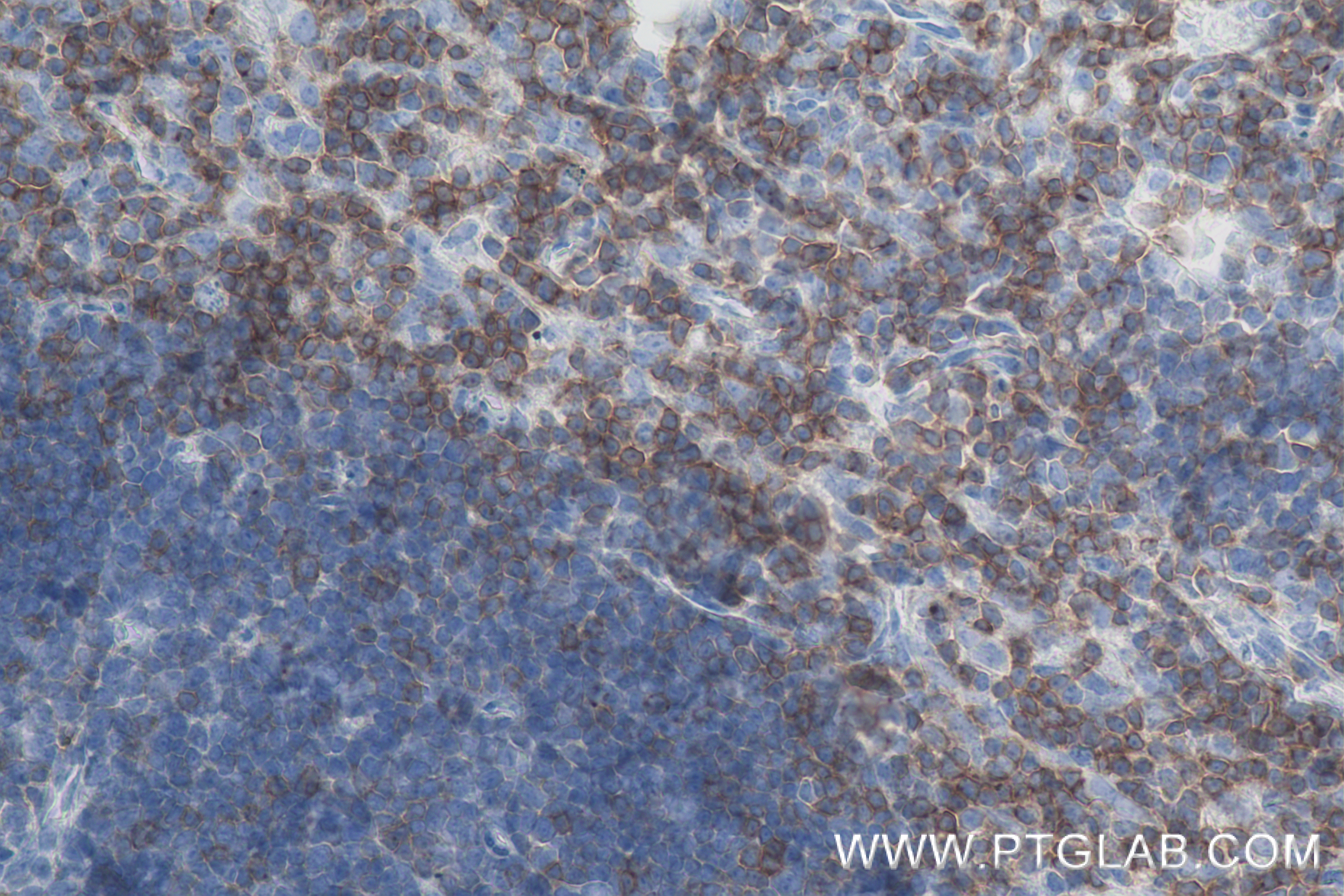 IHC staining of mouse thymus using 84360-4-RR
