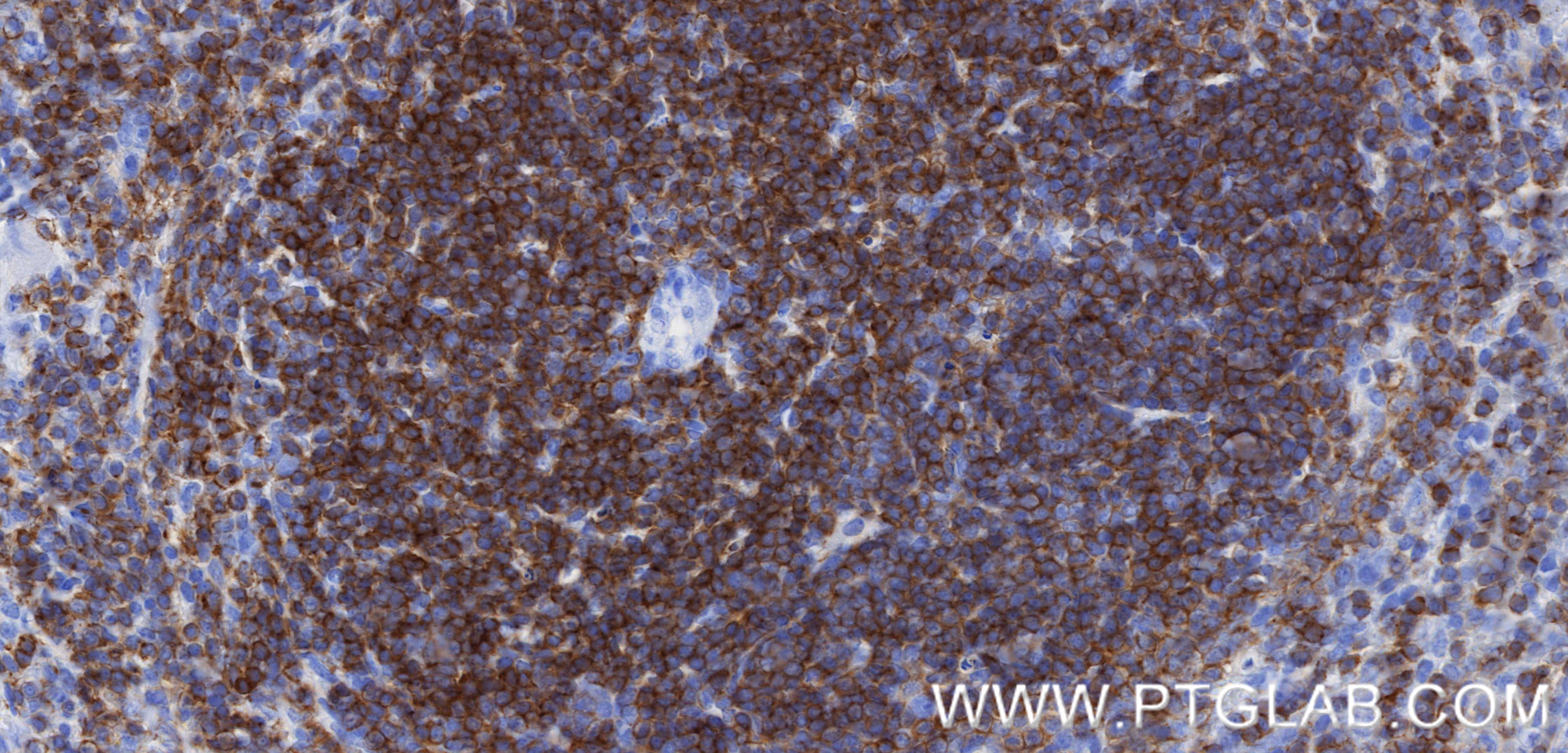 IHC staining of mouse spleen using 84360-4-RR