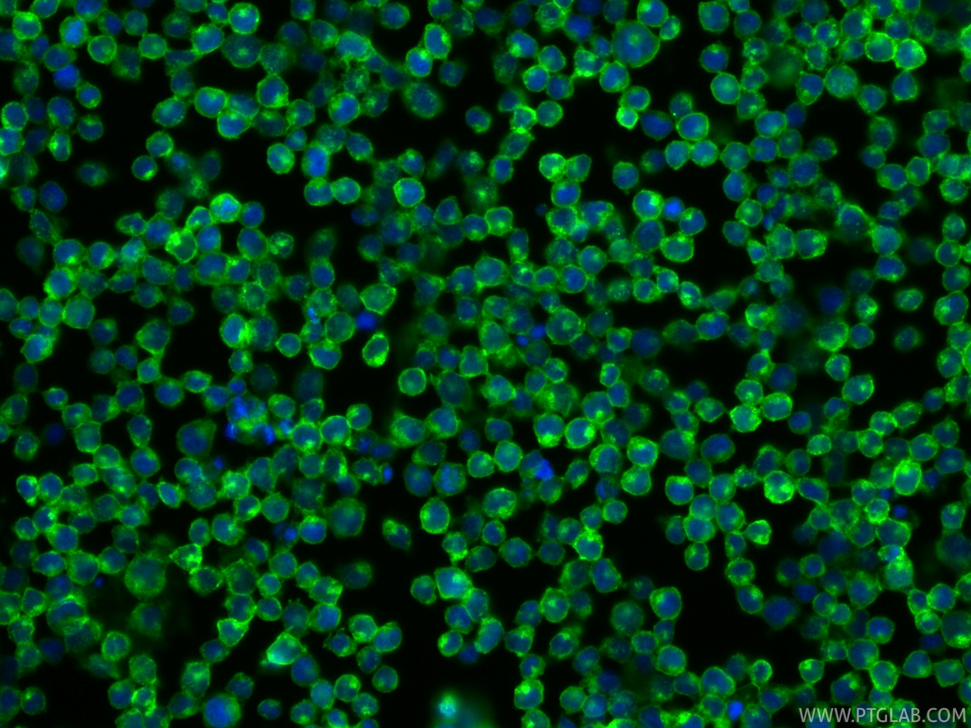 Immunofluorescent analysis of (4% PFA) fixed Jurkat cells using CoraLite® Plus 488 CD2 antibody (CL488-84108-5, Clone: 241222B8 ) at dilution of 1:200. IF Staining of Jurkat using CL488-84108-5