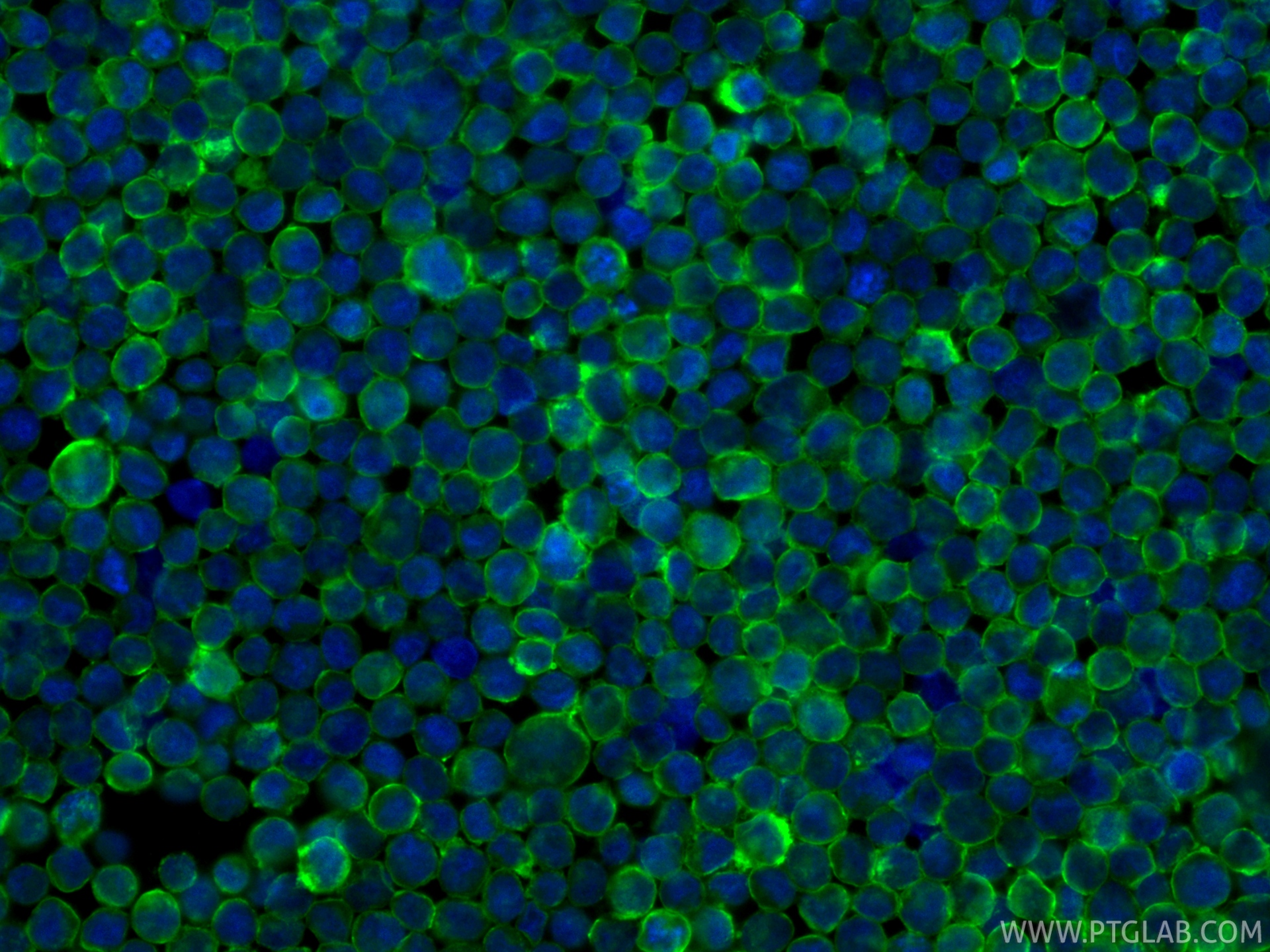 IF Staining of Raji using CL488-86480