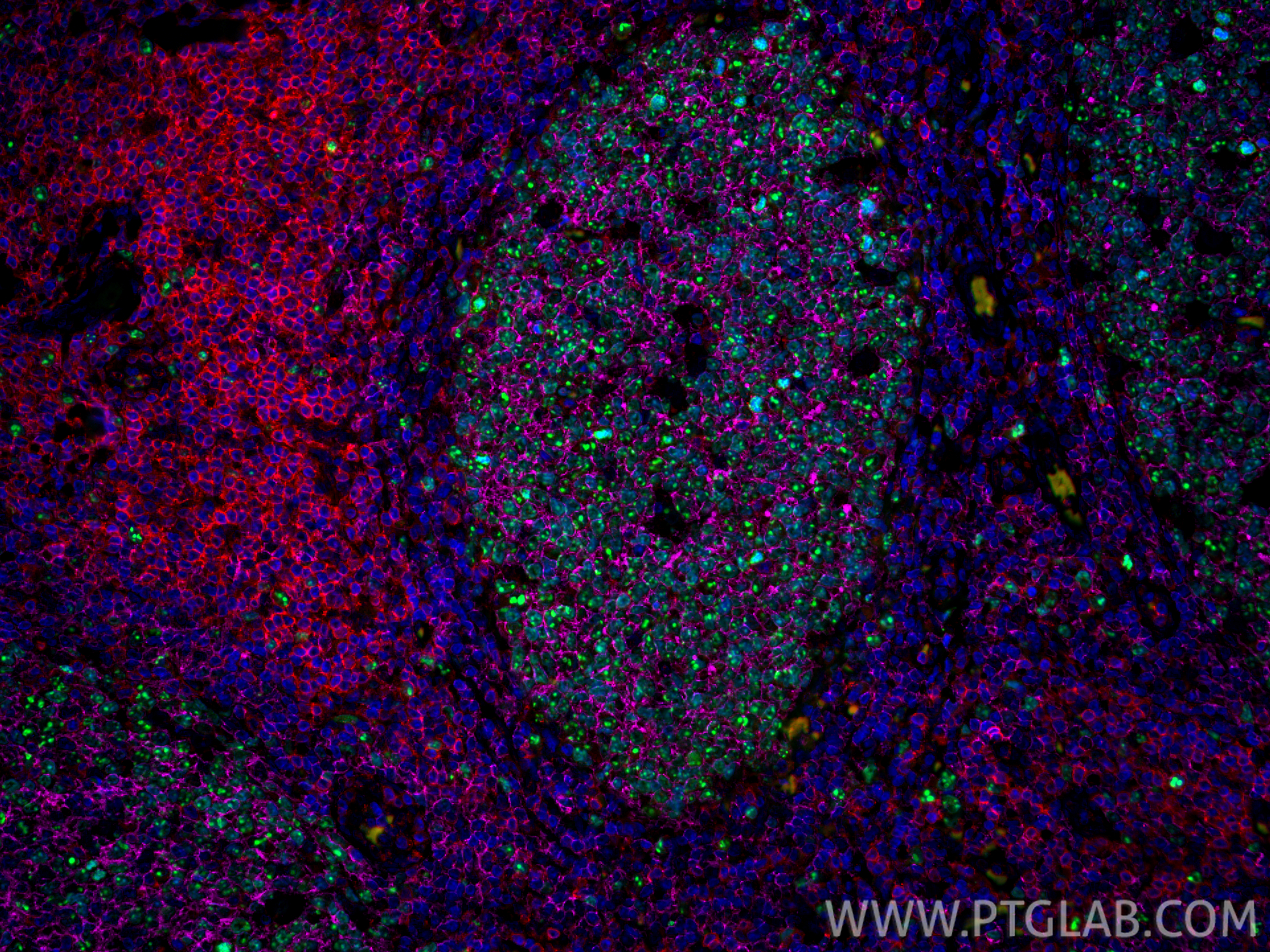 IF Staining of human tonsillitis using CL647-60271
