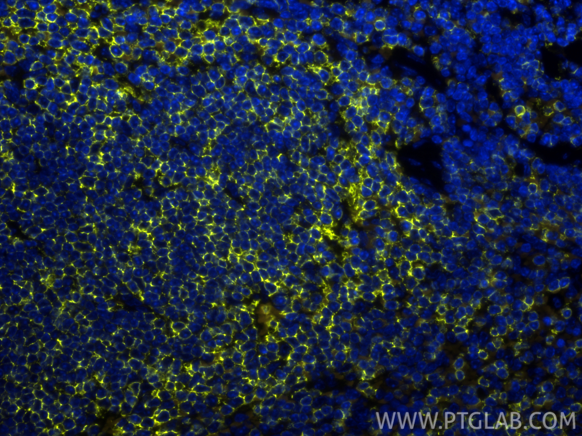 IF Staining of mouse spleen using PE-31909