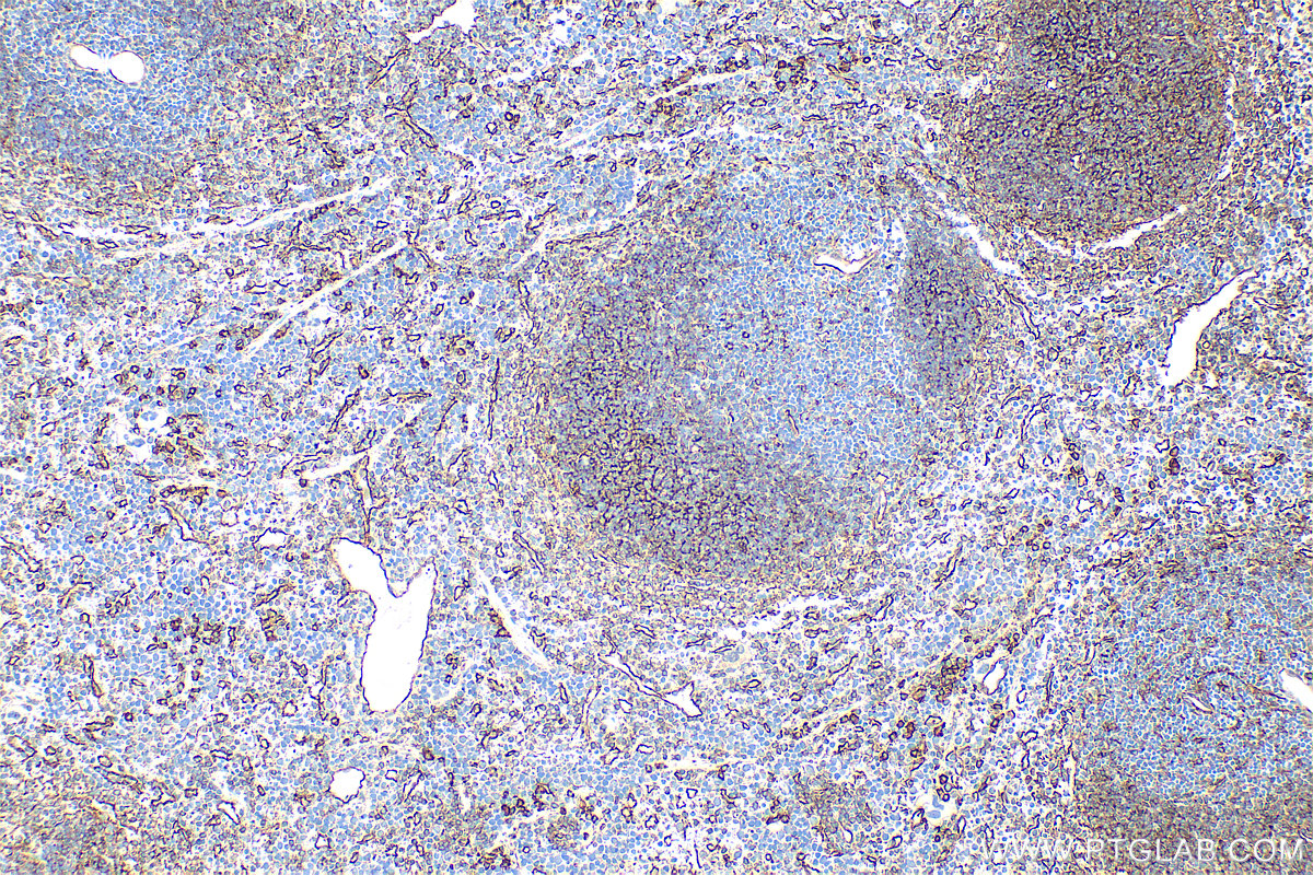 IHC staining of mouse spleen using 31444-1-AP
