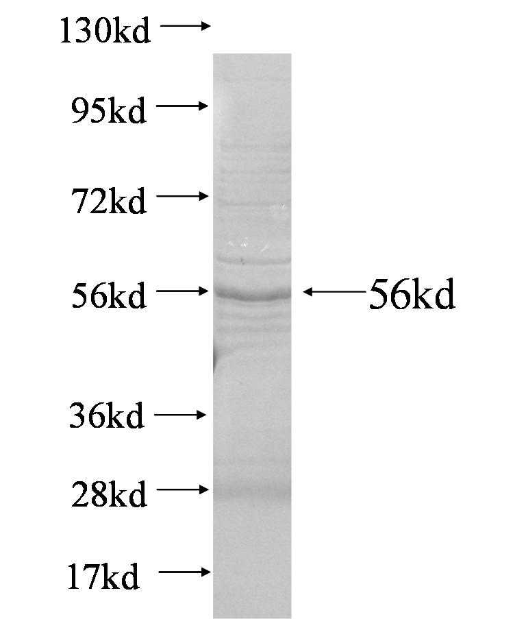 CD200 fusion protein Ag4768 SDS-PAGE CD200 fusion protein Ag4768 SDS-PAGE