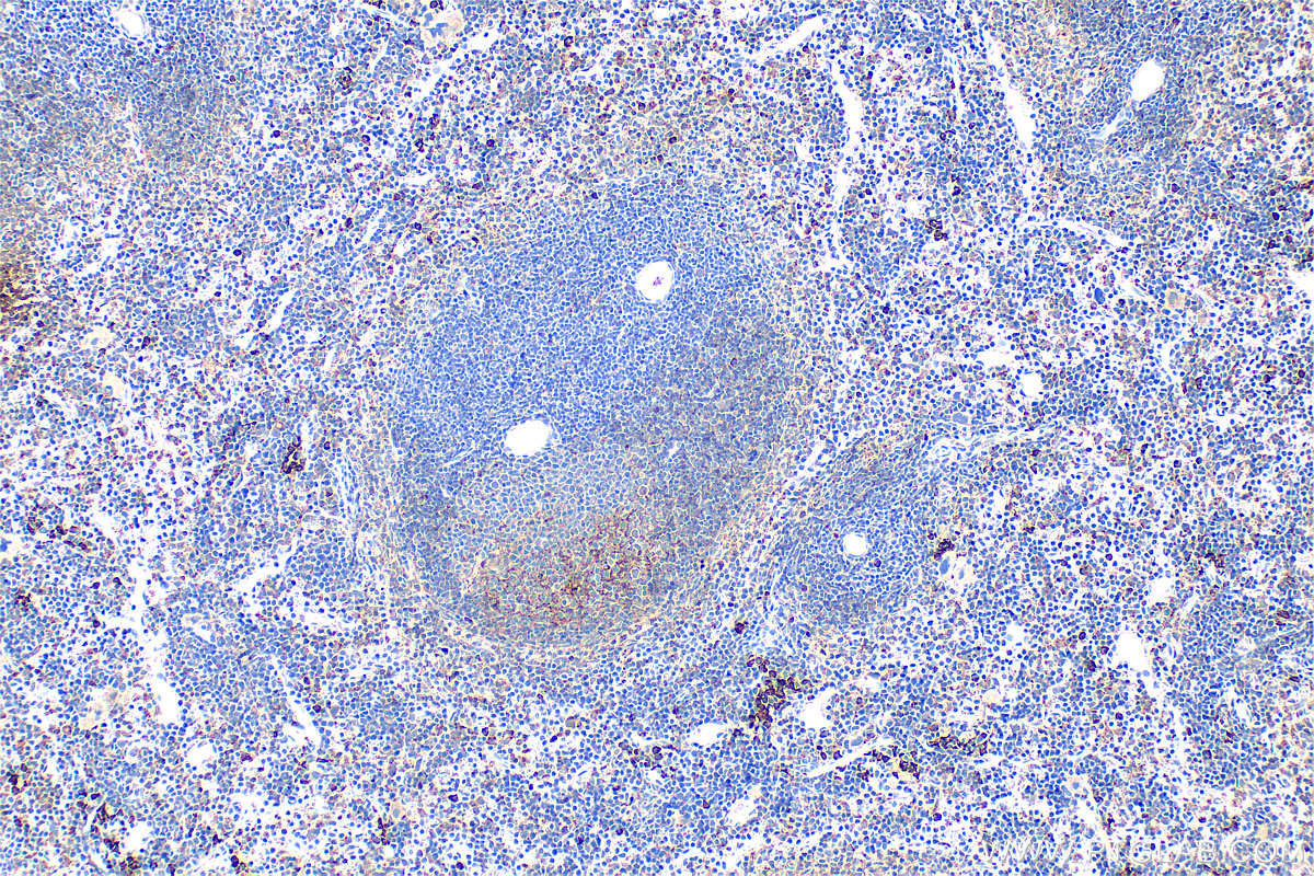 Immunohistochemical analysis of paraffin-embedded mouse spleen tissue slide using 34012-1-AP (CD200R1L antibody) at dilution of 1:400 (under 10x lens). Heat mediated antigen retrieval with Tris-EDTA buffer (pH 9.0). IHC staining of mouse spleen using 34012-1-AP