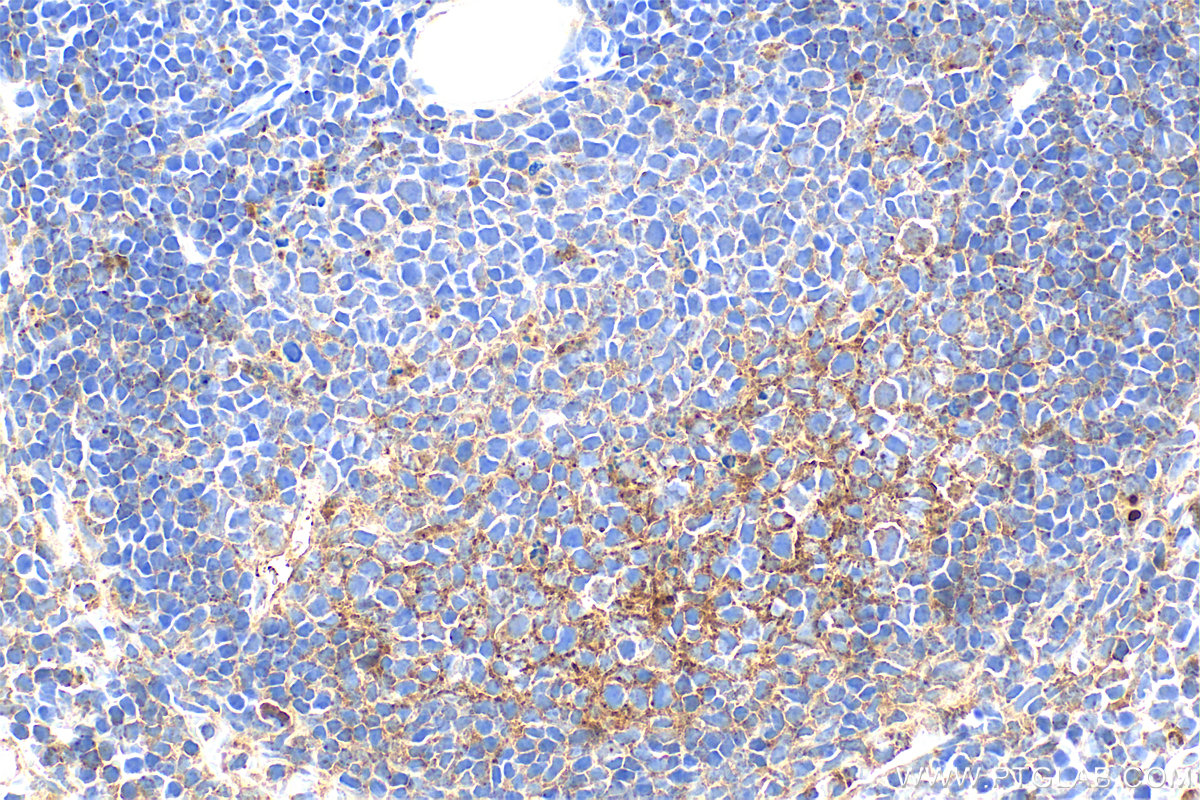 Immunohistochemical analysis of paraffin-embedded mouse spleen tissue slide using 34012-1-AP (CD200R1L antibody) at dilution of 1:400 (under 40x lens). Heat mediated antigen retrieval with Tris-EDTA buffer (pH 9.0). IHC staining of mouse spleen using 34012-1-AP