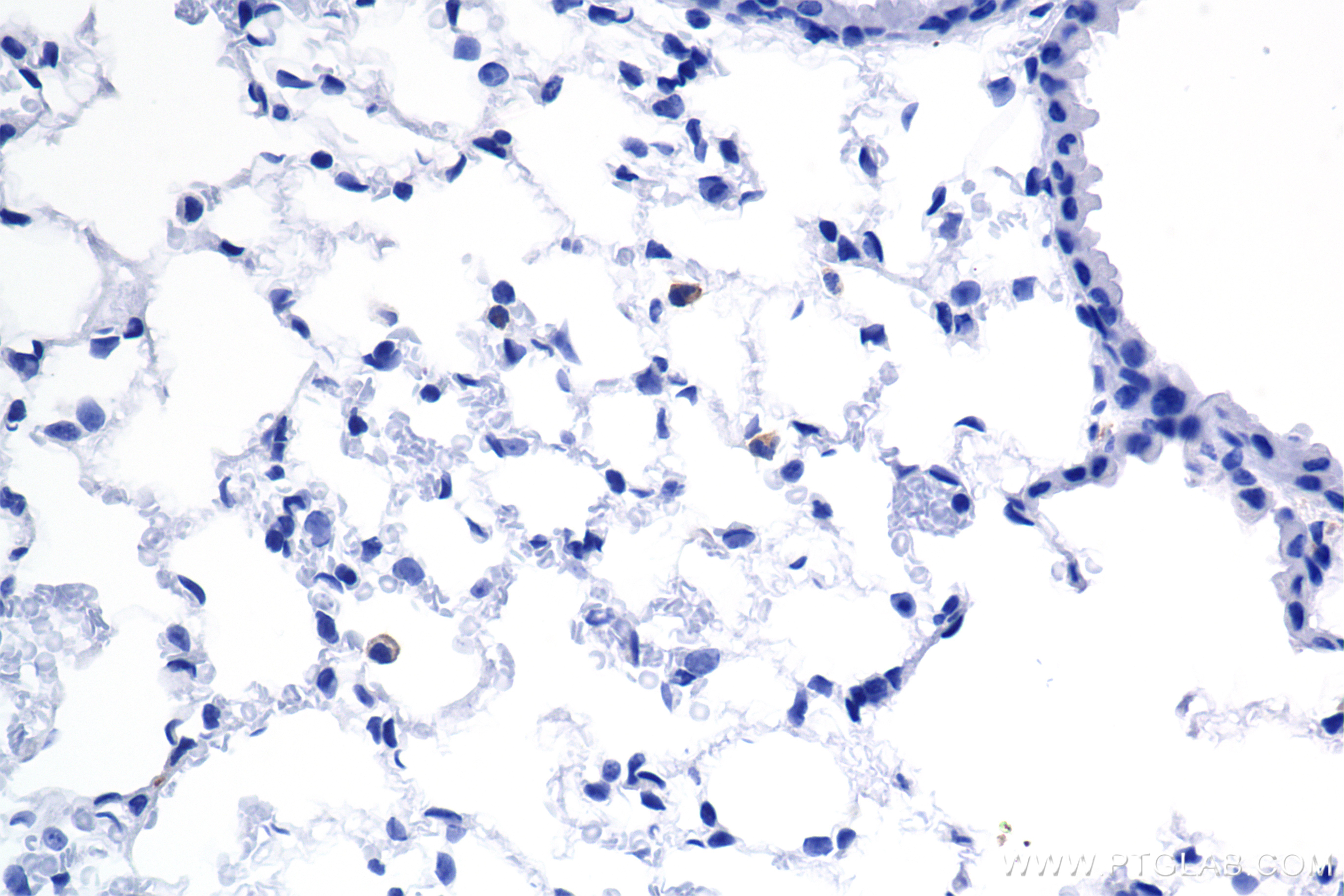 IHC staining of mouse lung using 86552-3-RR