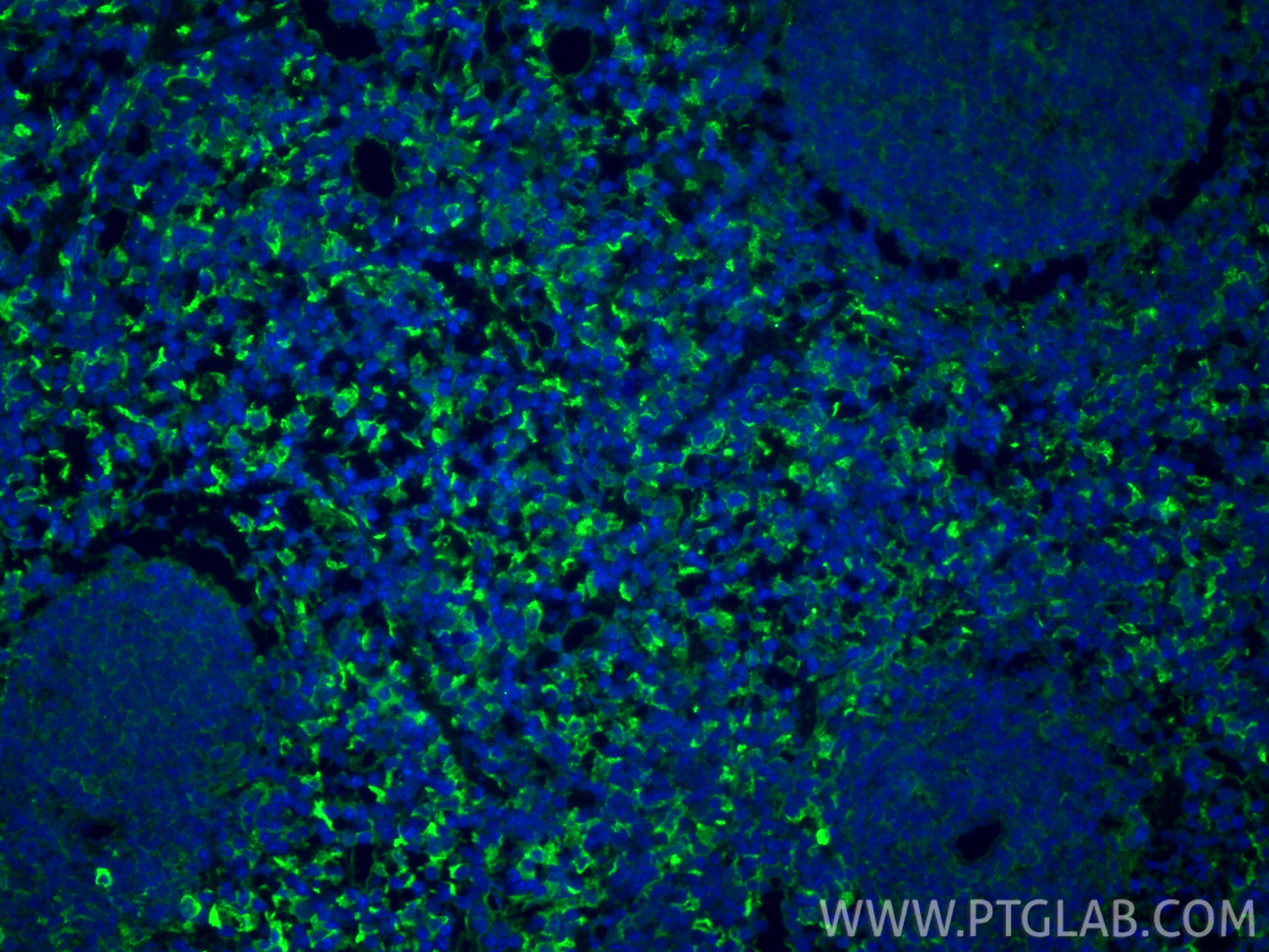 IF Staining of mouse spleen using 32647-1-AP