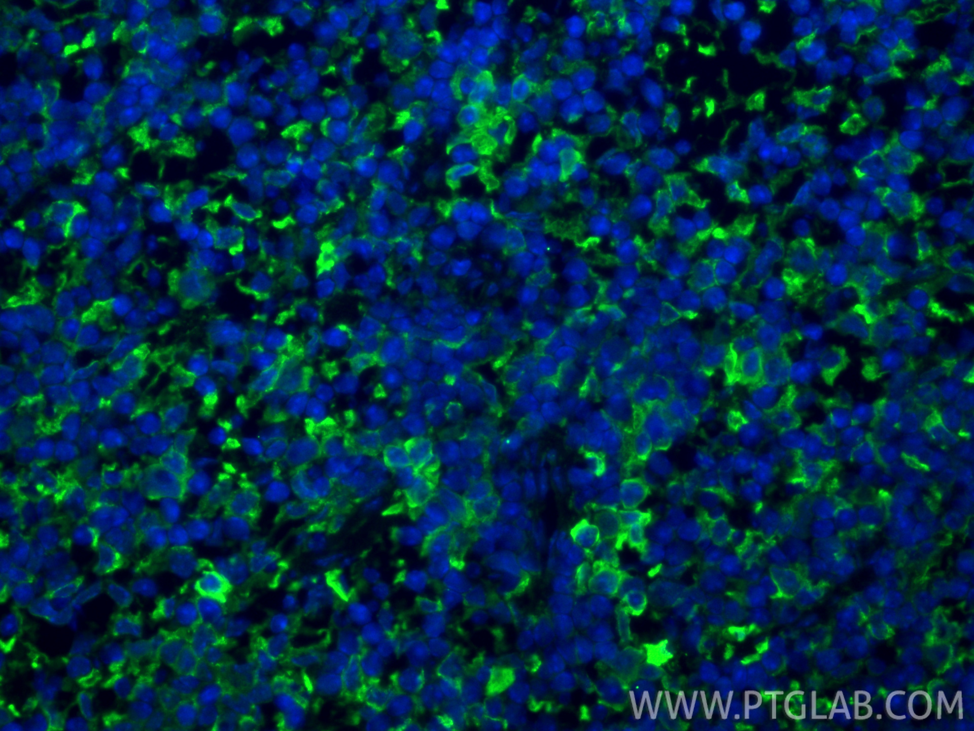 IF Staining of mouse spleen using 32647-1-AP