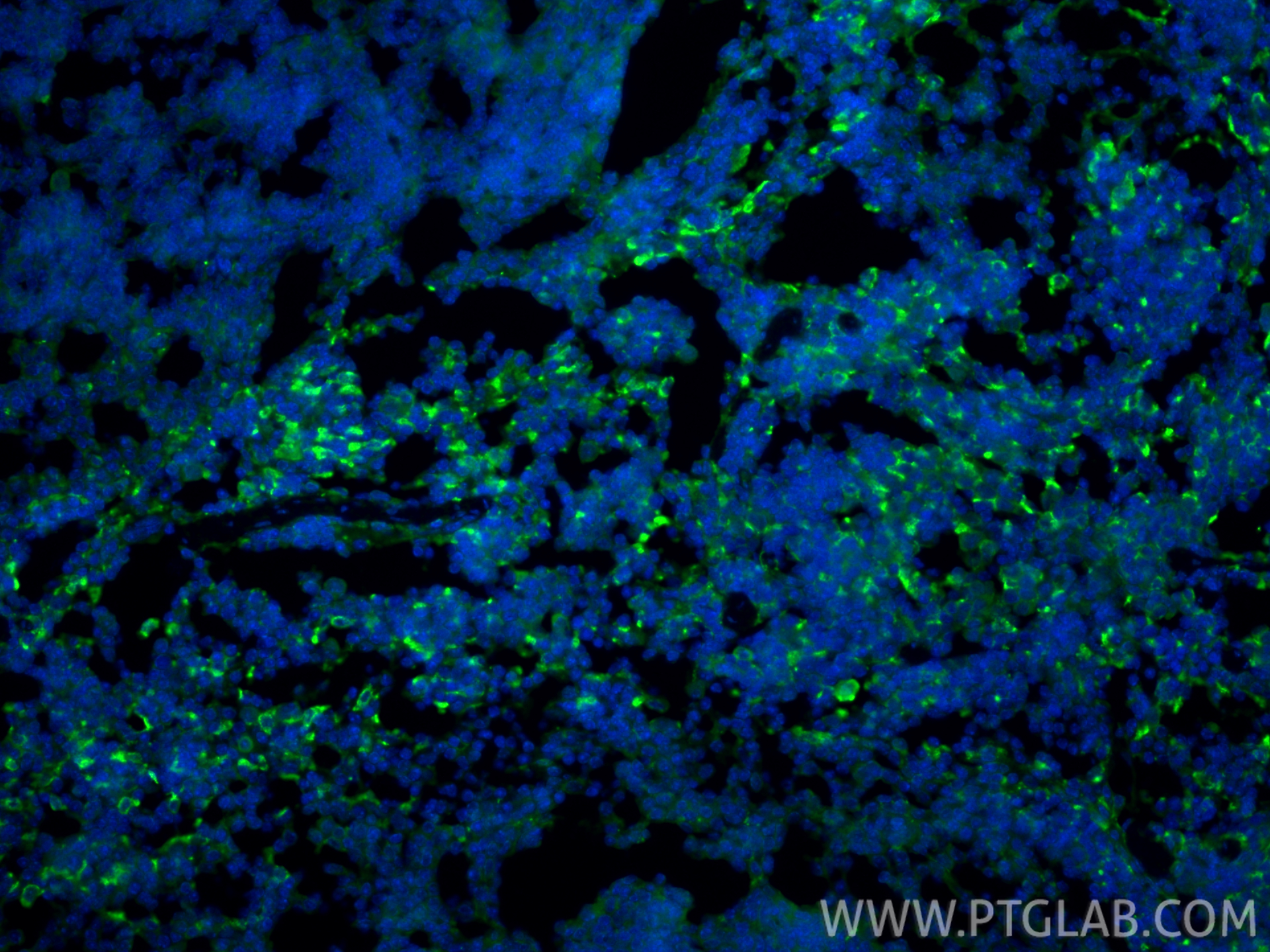 IF Staining of mouse spleen using 32647-1-AP IF Staining of mouse spleen using 32647-1-AP