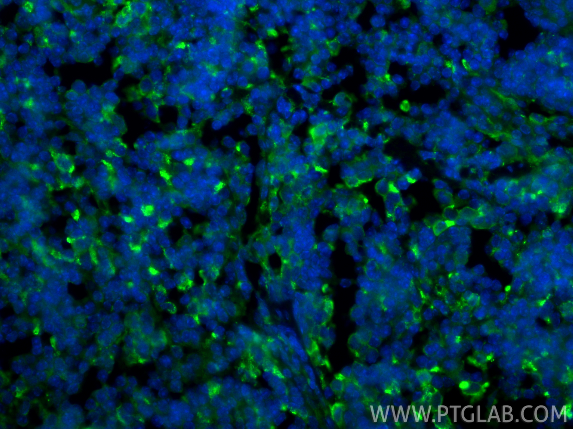 IF Staining of mouse spleen using 32647-1-AP IF Staining of mouse spleen using 32647-1-AP