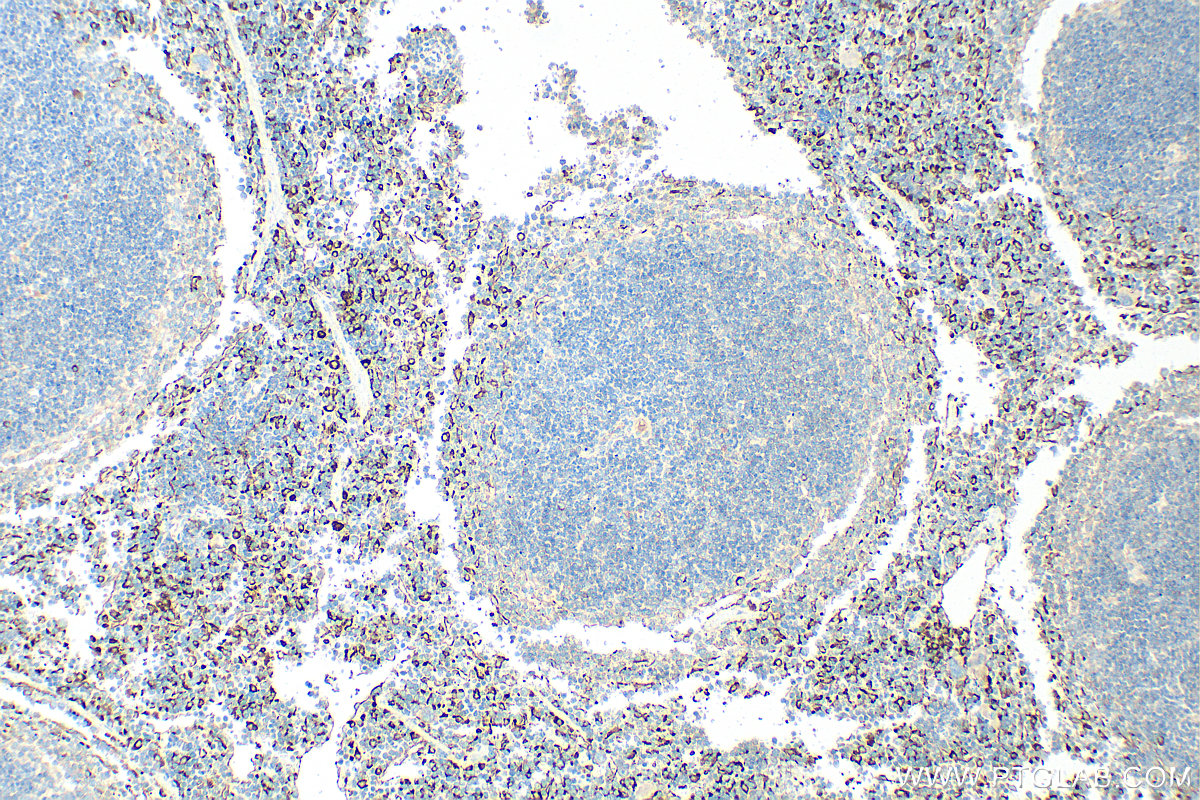 IHC staining of mouse spleen using 32647-1-AP