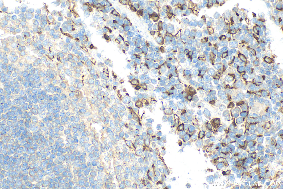 IHC staining of mouse spleen using 32647-1-AP