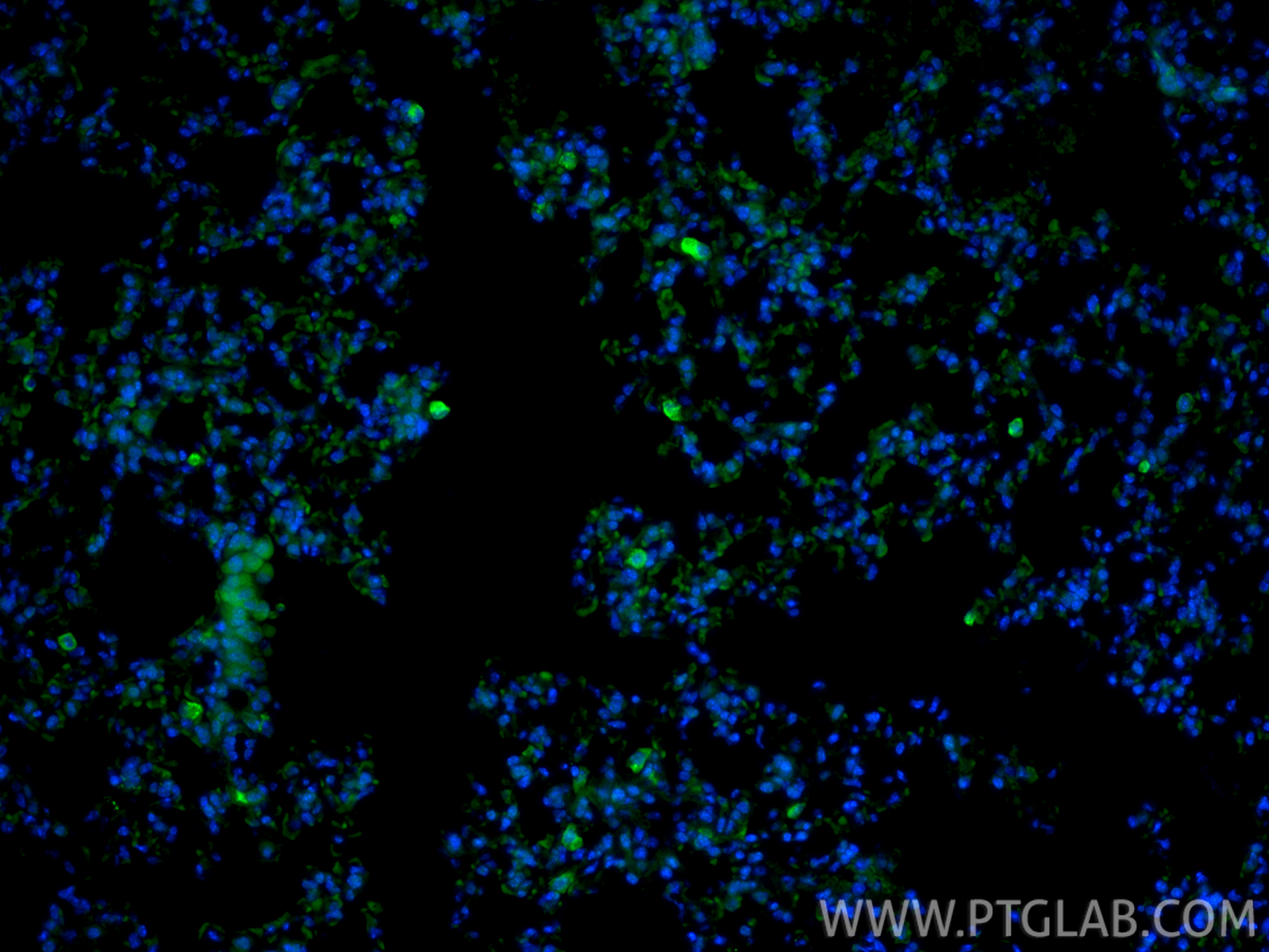 IF Staining of mouse lung using 83485-1-RR IF Staining of mouse lung using 83485-1-RR
