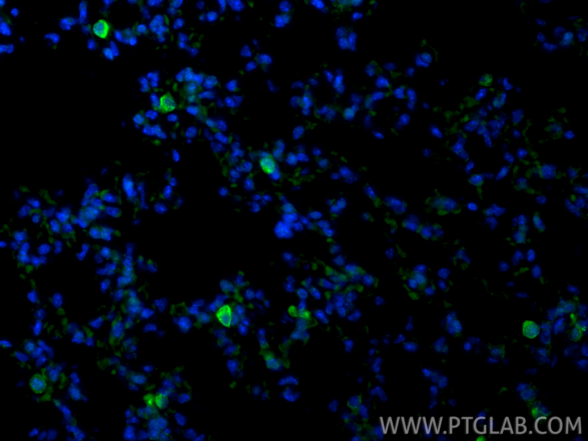 IF Staining of mouse lung using 83485-1-RR IF Staining of mouse lung using 83485-1-RR