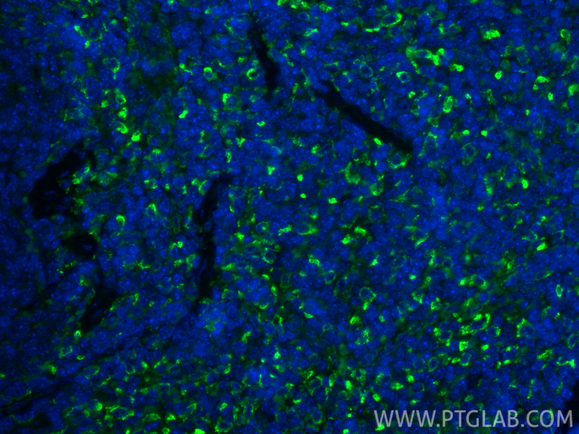 IF Staining of mouse spleen using 83485-1-RR IF Staining of mouse spleen using 83485-1-RR