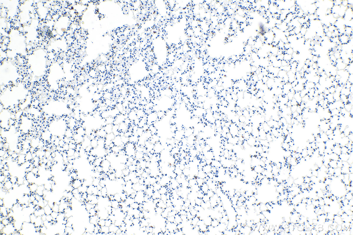 IHC staining of mouse lung using 83485-1-RR (same clone as 83485-1-PBS)