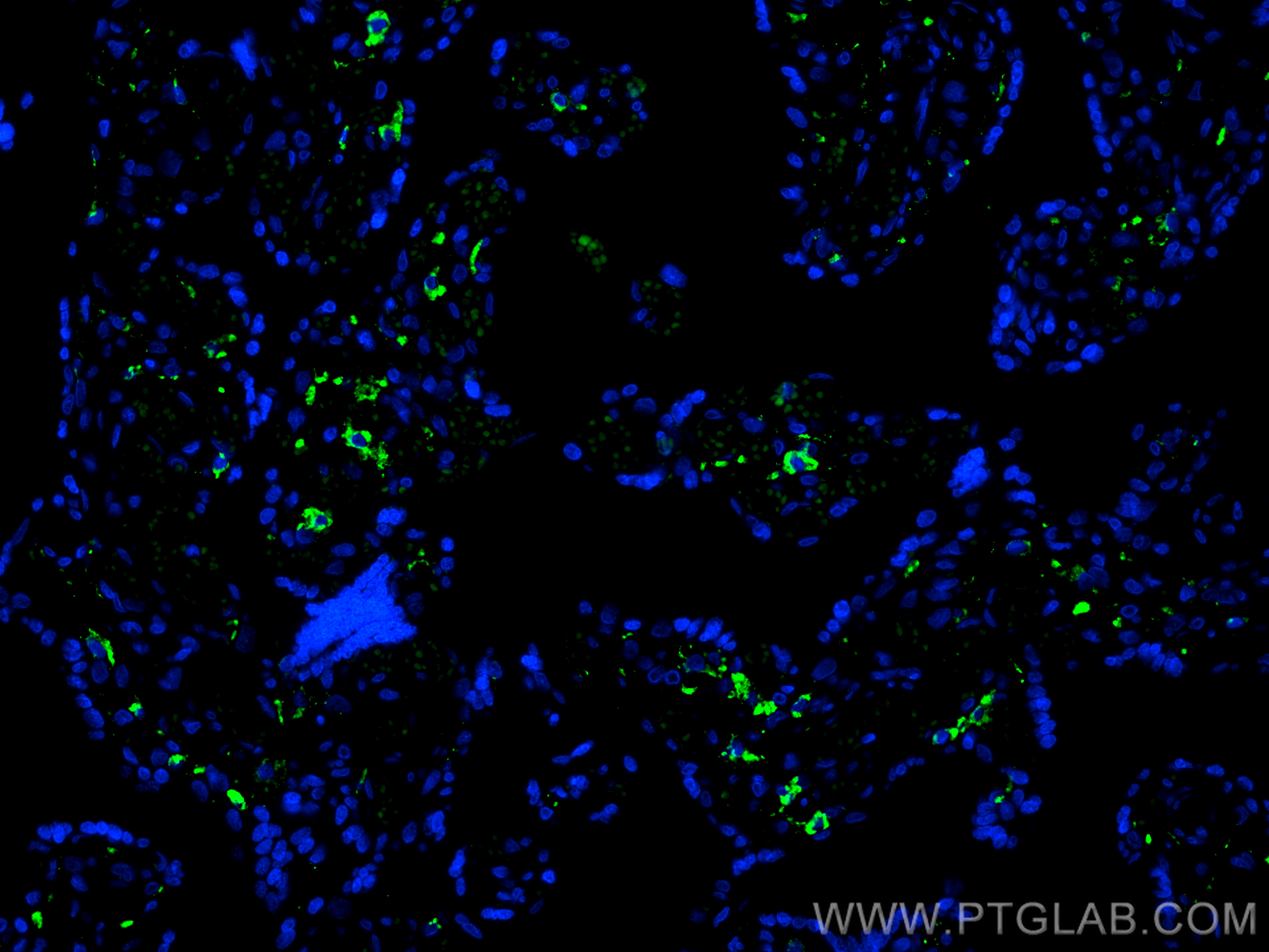 IF Staining of human placenta using CL488-18704