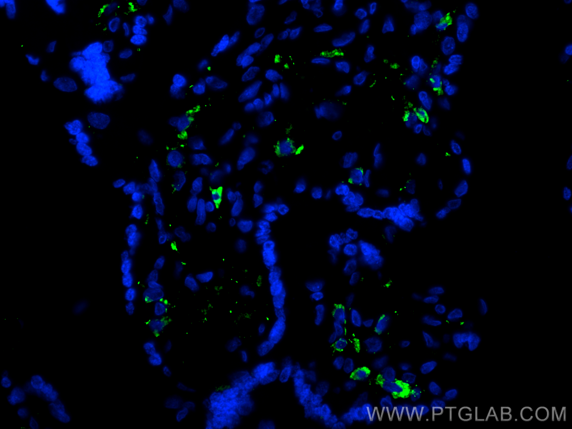 IF Staining of human placenta using CL488-18704