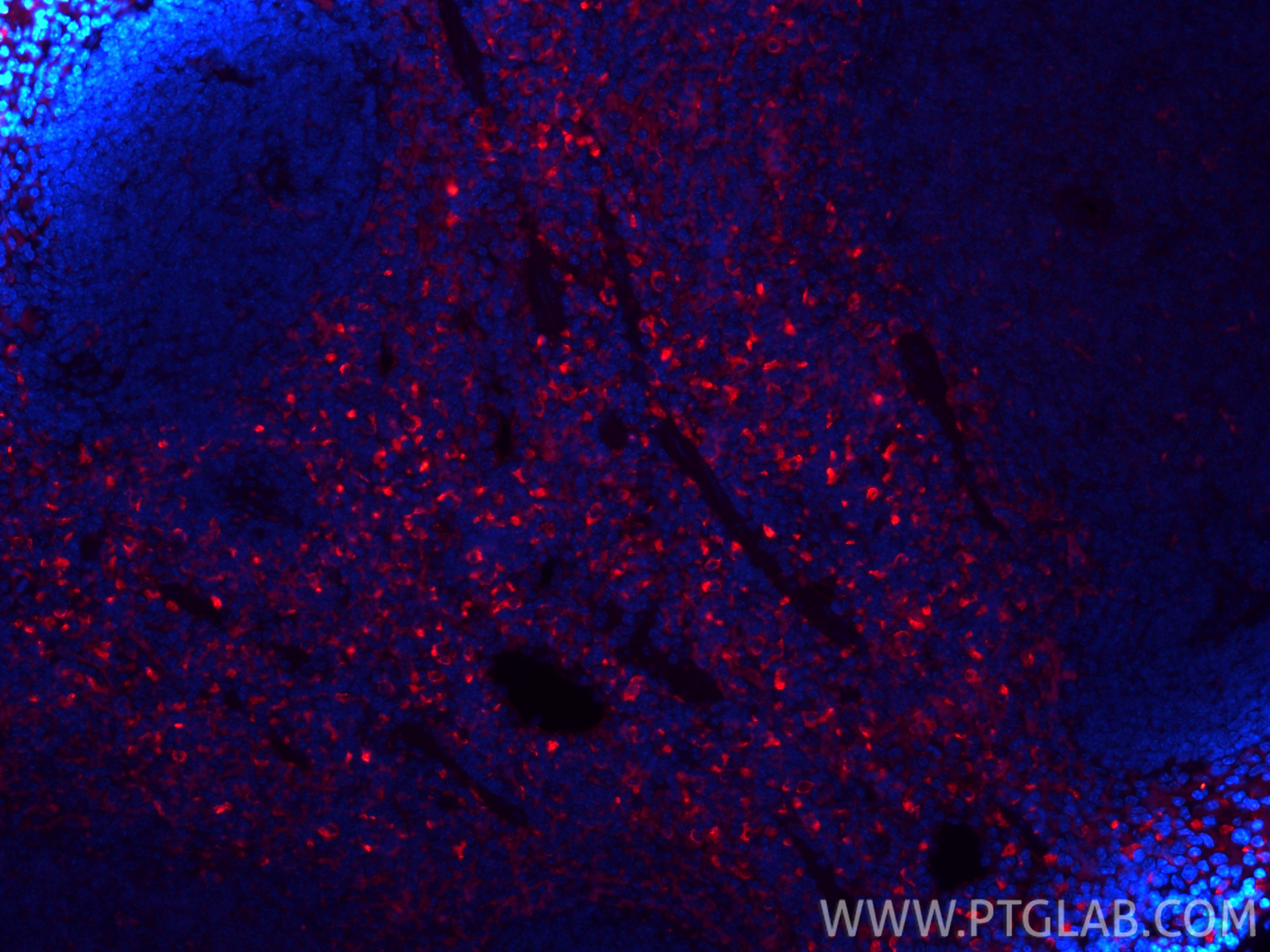 IF Staining of mouse spleen using CL594-83485