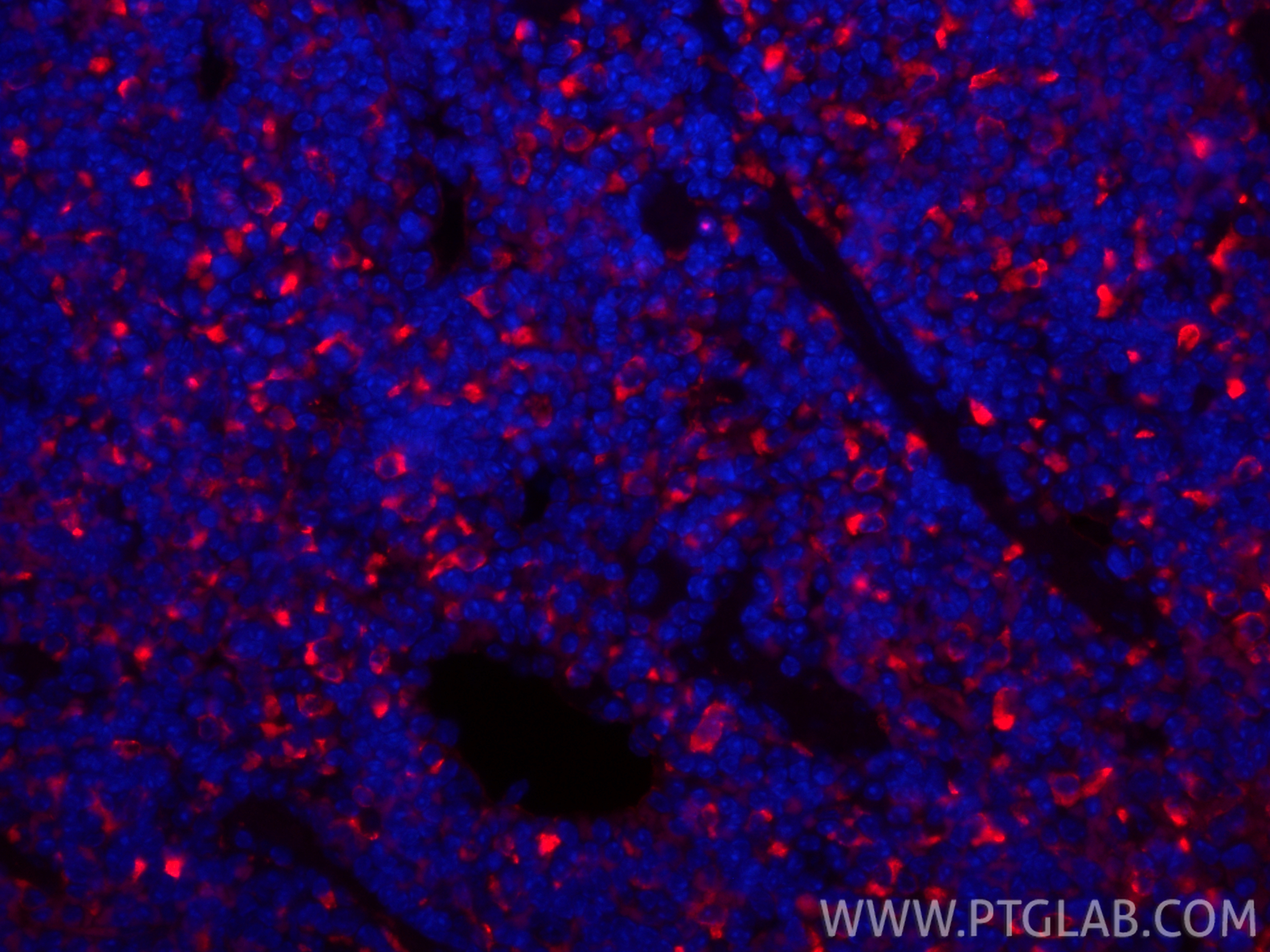 IF Staining of mouse spleen using CL594-83485