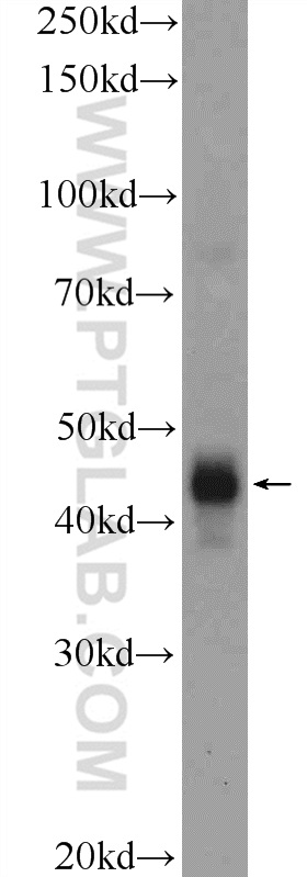 CD209 Polyclonal antibody