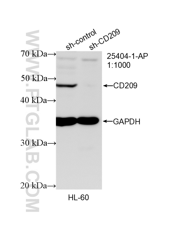 WB analysis of HL-60 using 25404-1-AP