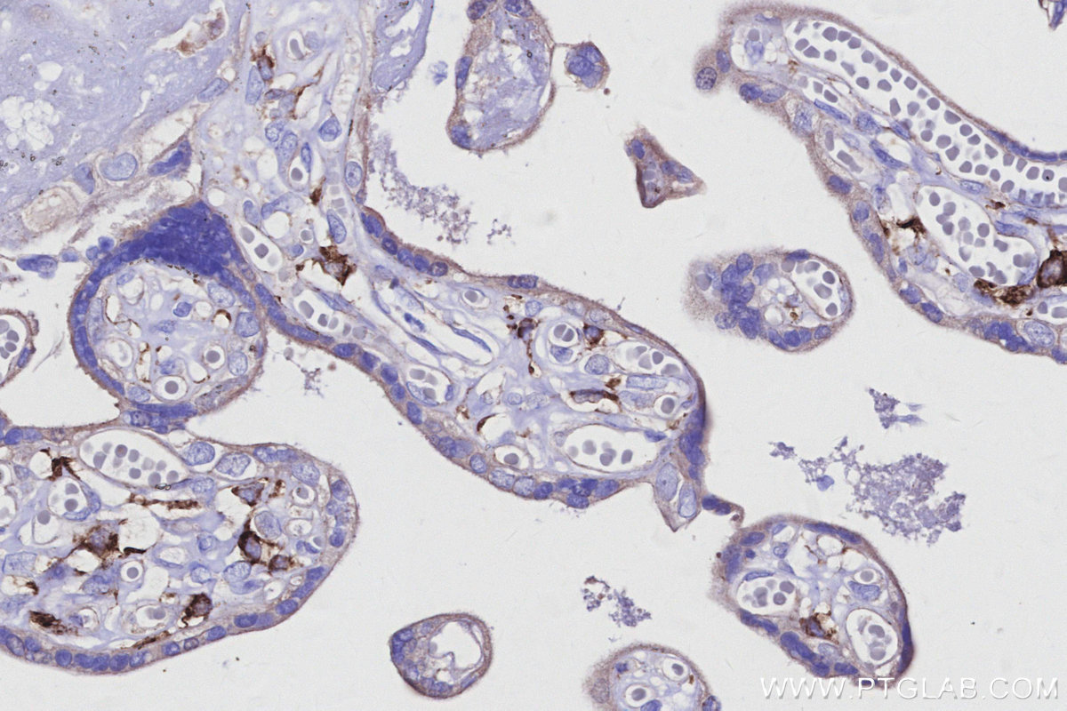 IHC staining of human placenta using 31621-1-AP IHC staining of human placenta using 31621-1-AP