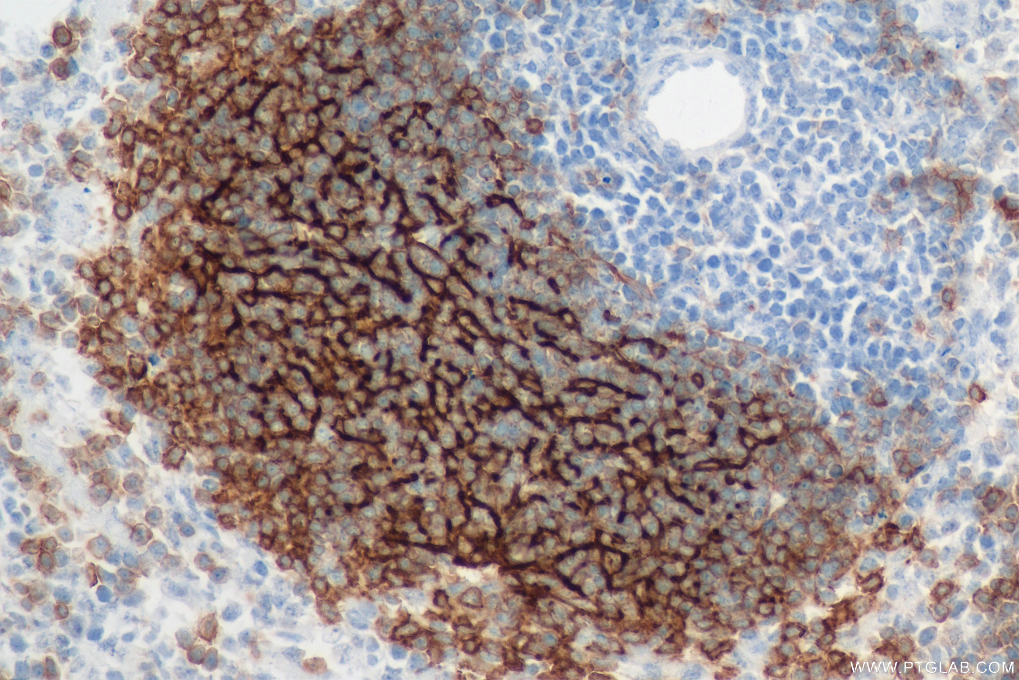 IHC staining of mouse spleen using 84565-2-RR (same clone as 84565-2-PBS)