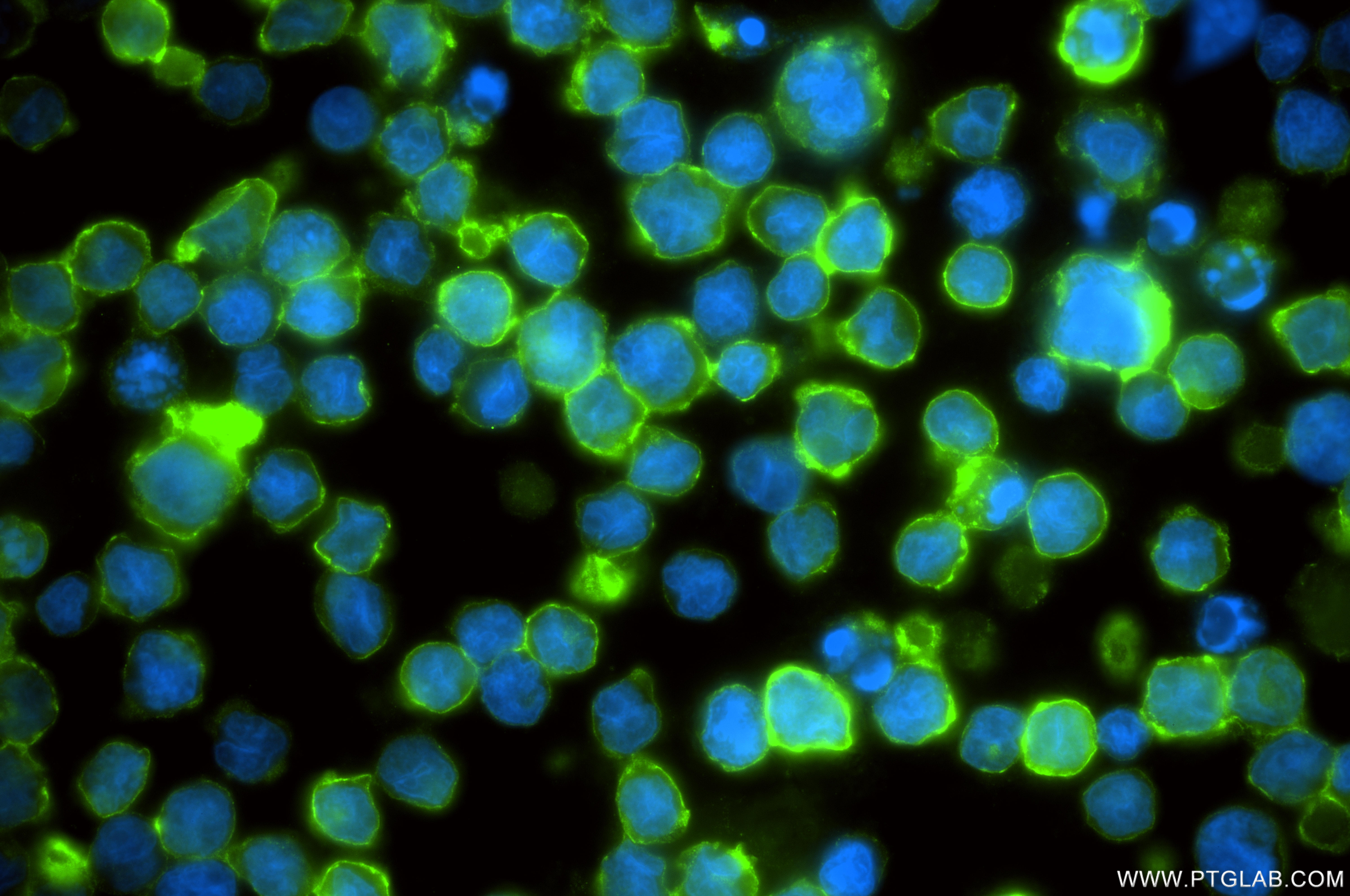 Immunofluorescent analysis of (4% PFA) fixed Raji cells using CD21 antibody (<a class='green' href='/productredirect?CatalogNo=87097-1-RR' target='_blank'>87097-1-RR</a>, Clone: 252181F1 ) at dilution of 1:200 and CoraLite®488-Conjugated Goat Anti-Rabbit IgG(H+L) (<a class='green' href='/productredirect?CatalogNo=SA00013-2' target='_blank'>SA00013-2</a>). This data was developed using the same antibody clone with 87097-1-PBS in a different storage buffer formulation. IF Staining of Raji using 87097-1-RR (same clone as 87097-1-PBS)