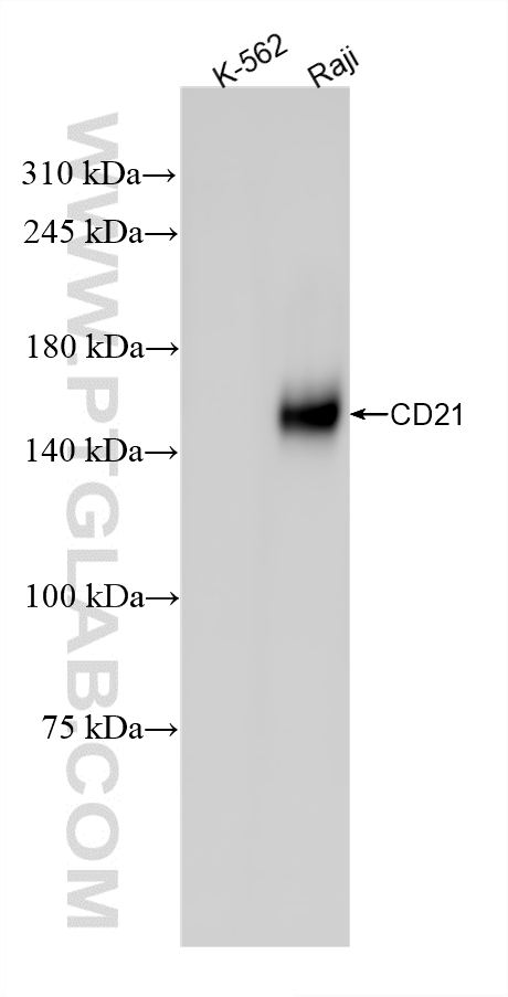 Raji cells were subjected to SDS PAGE followed by western blot with <a class='green' href='/productredirect?CatalogNo=87097-1-RR' target='_blank'>87097-1-RR</a> (CR2 antibody) at dilution of 1:2000 incubated at room temperature for 1.5 hours. This data was developed using the same antibody clone with 87097-1-PBS in a different storage buffer formulation. WB analysis of Raji using 87097-1-RR (same clone as 87097-1-PBS)