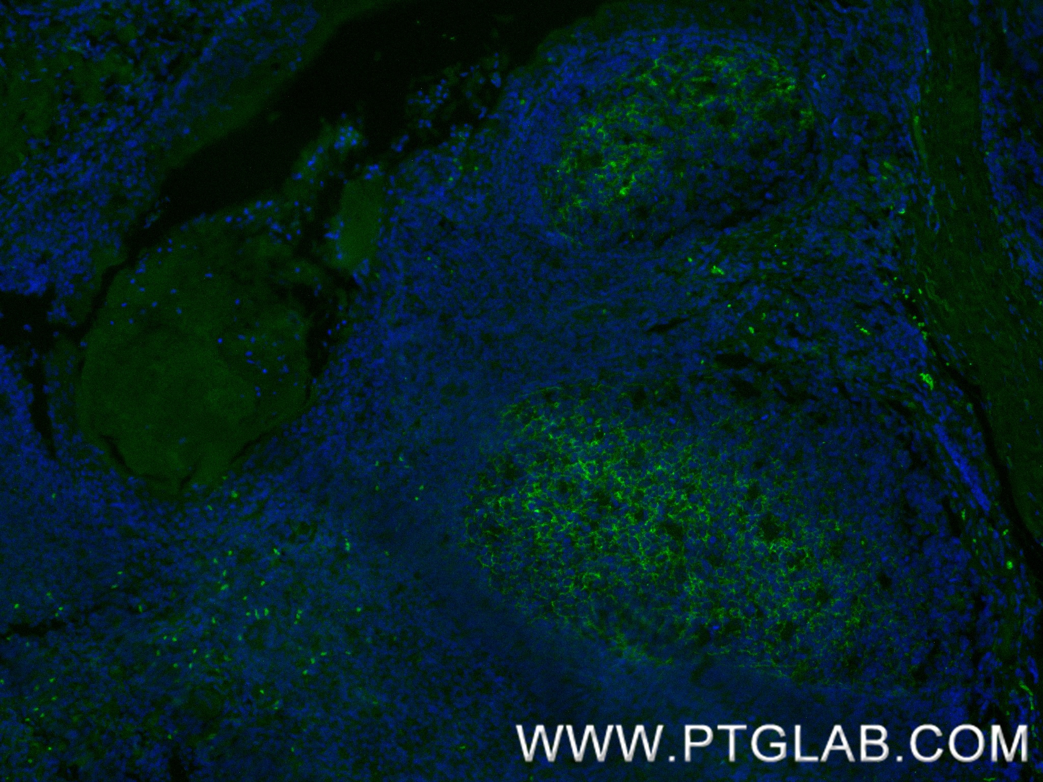 IF Staining of human tonsil using 87097-5-RR