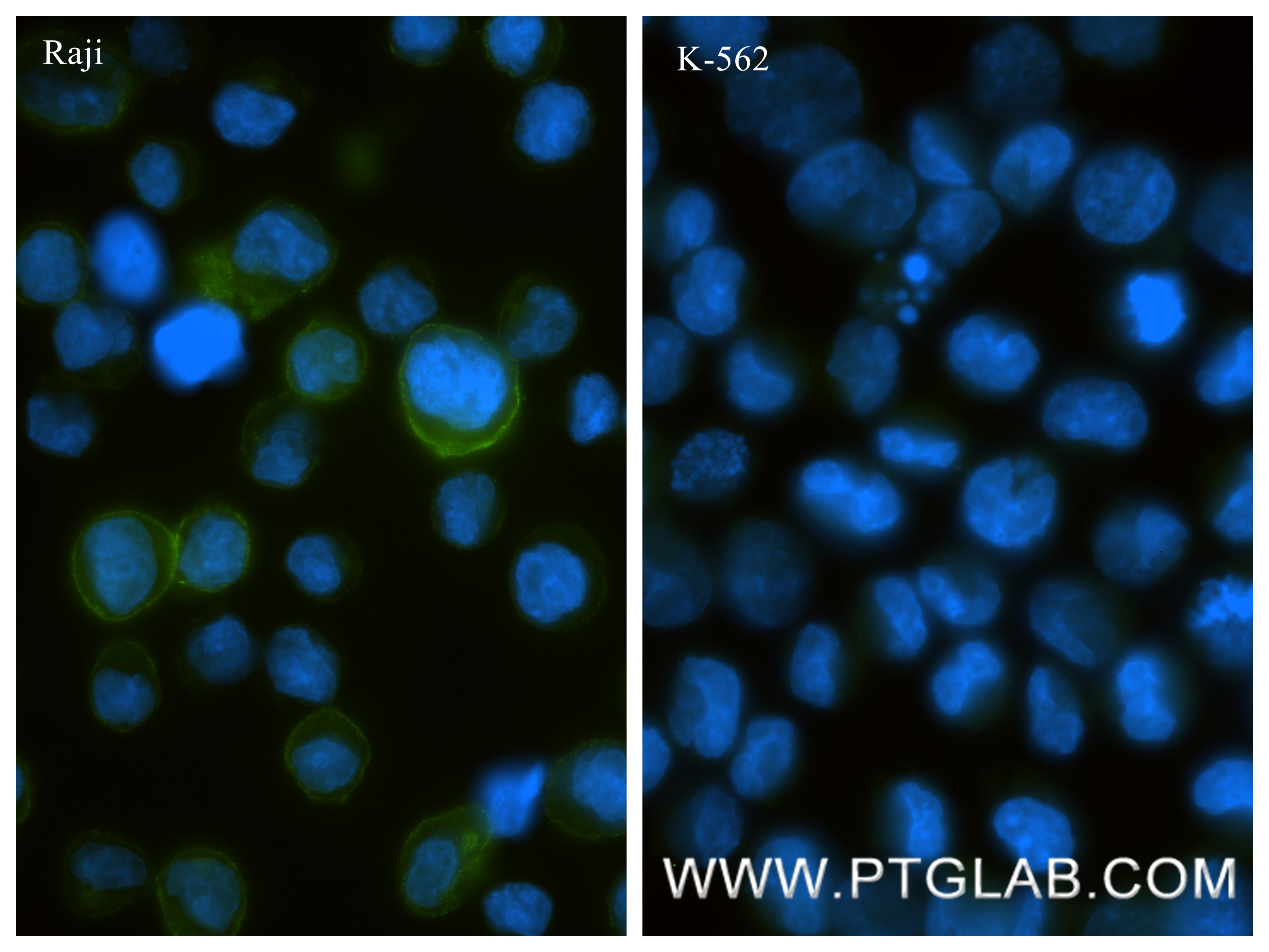IF Staining of Raji using 87097-5-RR