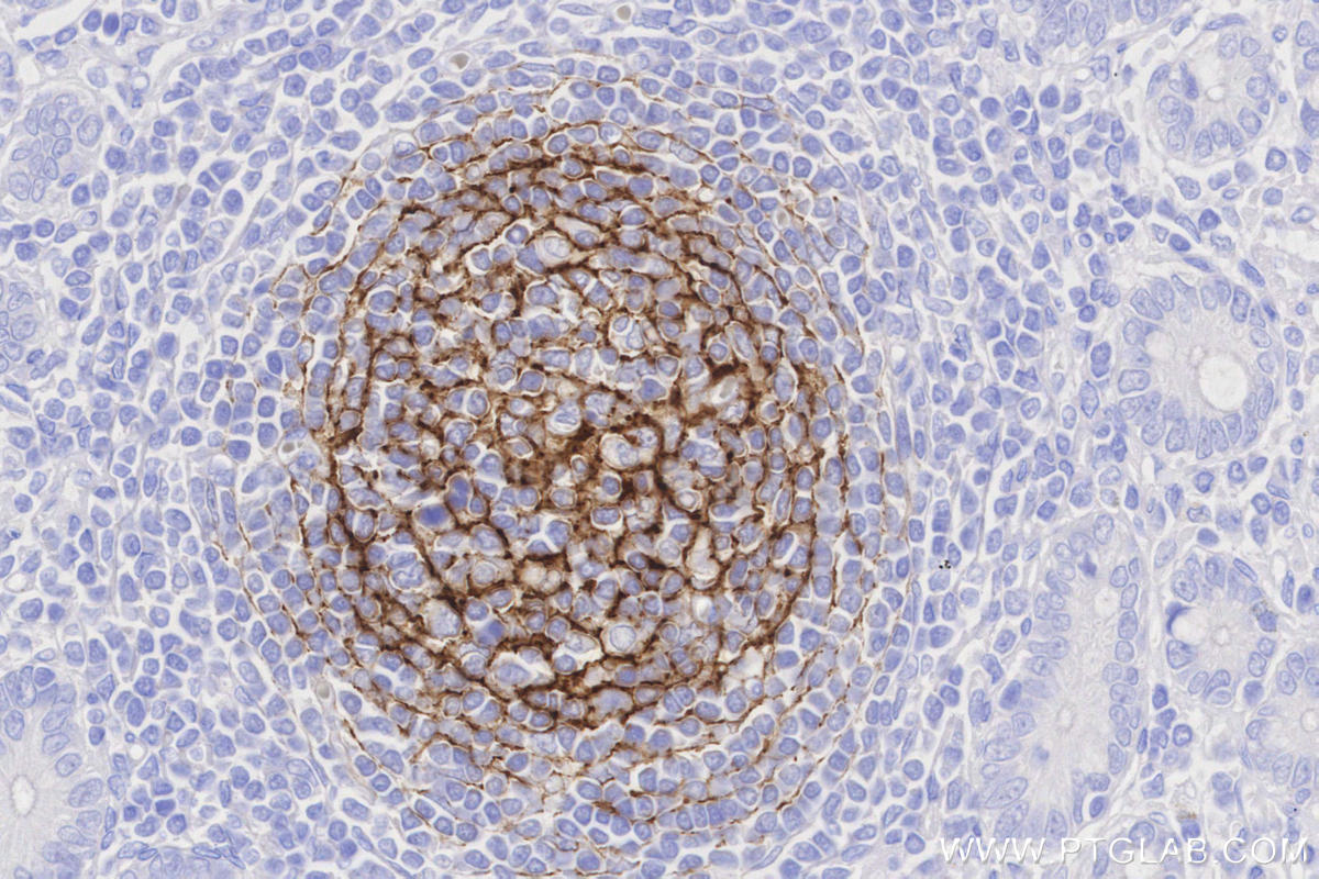 IHC staining of human small intestine using 87097-5-RR