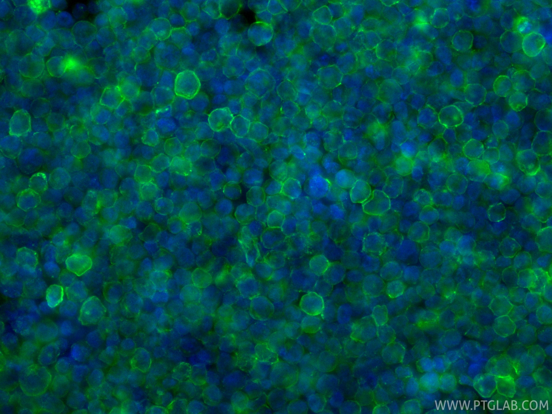 IF Staining of Raji using CL488-87097-5 IF Staining of Raji using CL488-87097-5