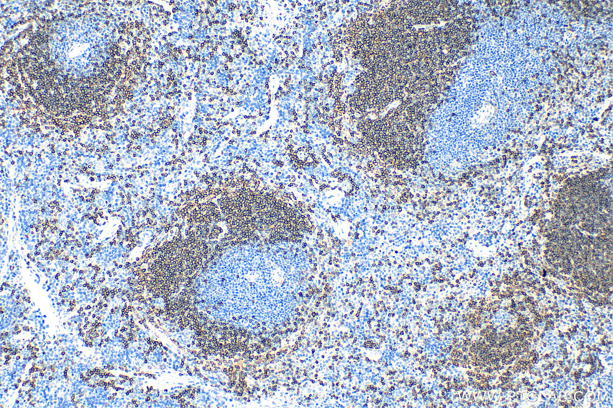 IHC staining of mouse spleen using 32183-1-AP